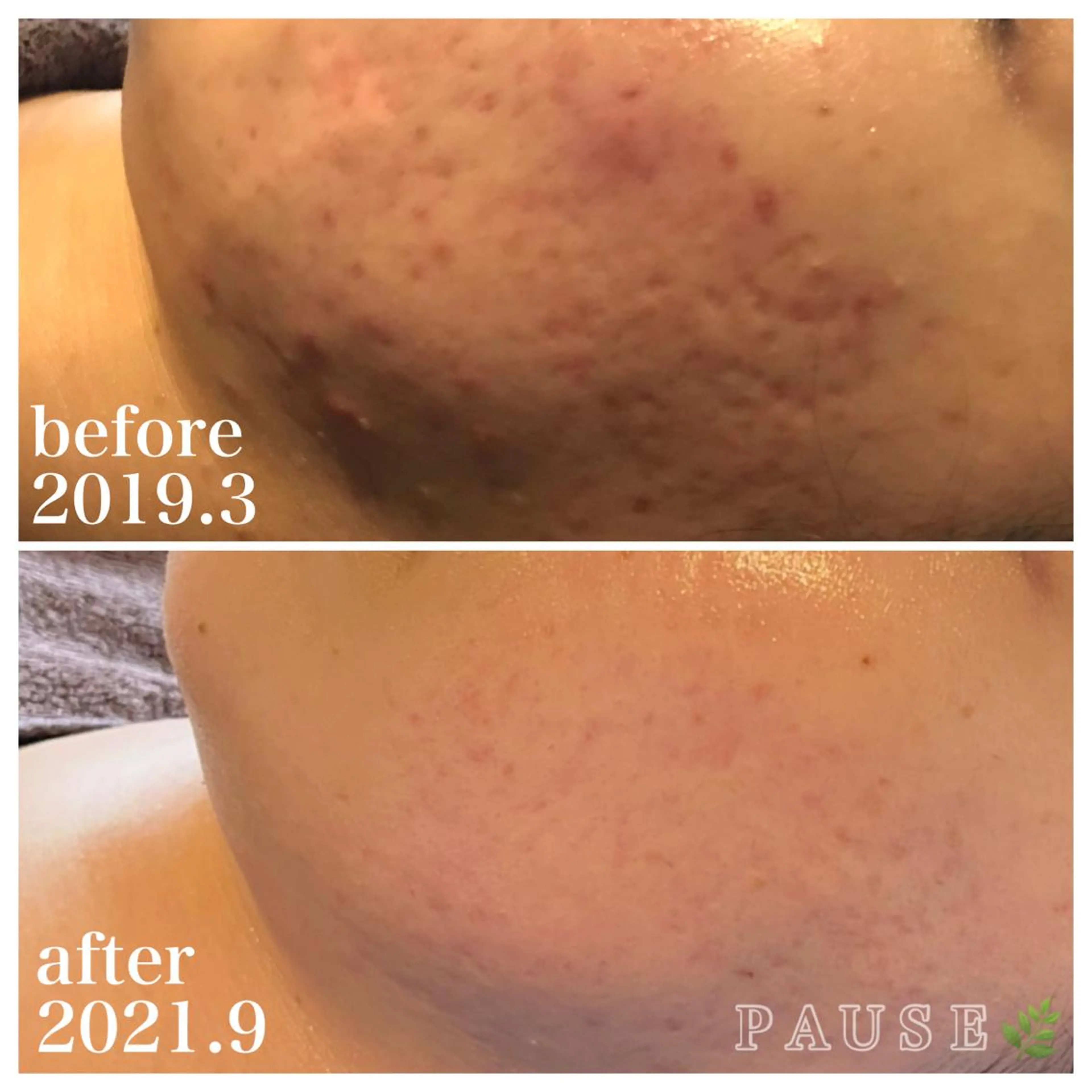 エステ 浜野 恵美のエステ・リラクイメージ