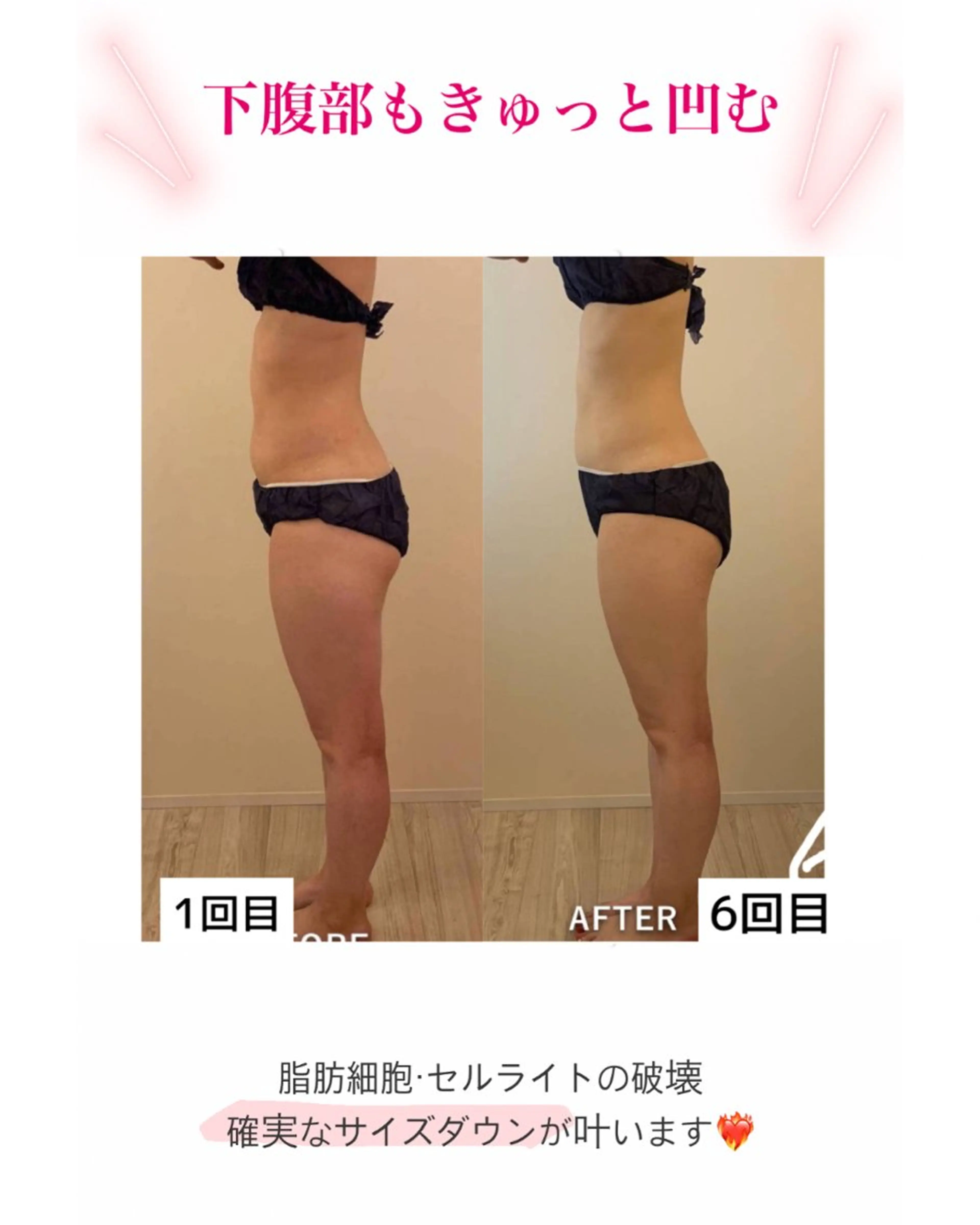 産後ダイエット−9㎏ Pourvous結衣のエステ・リラクイメージ