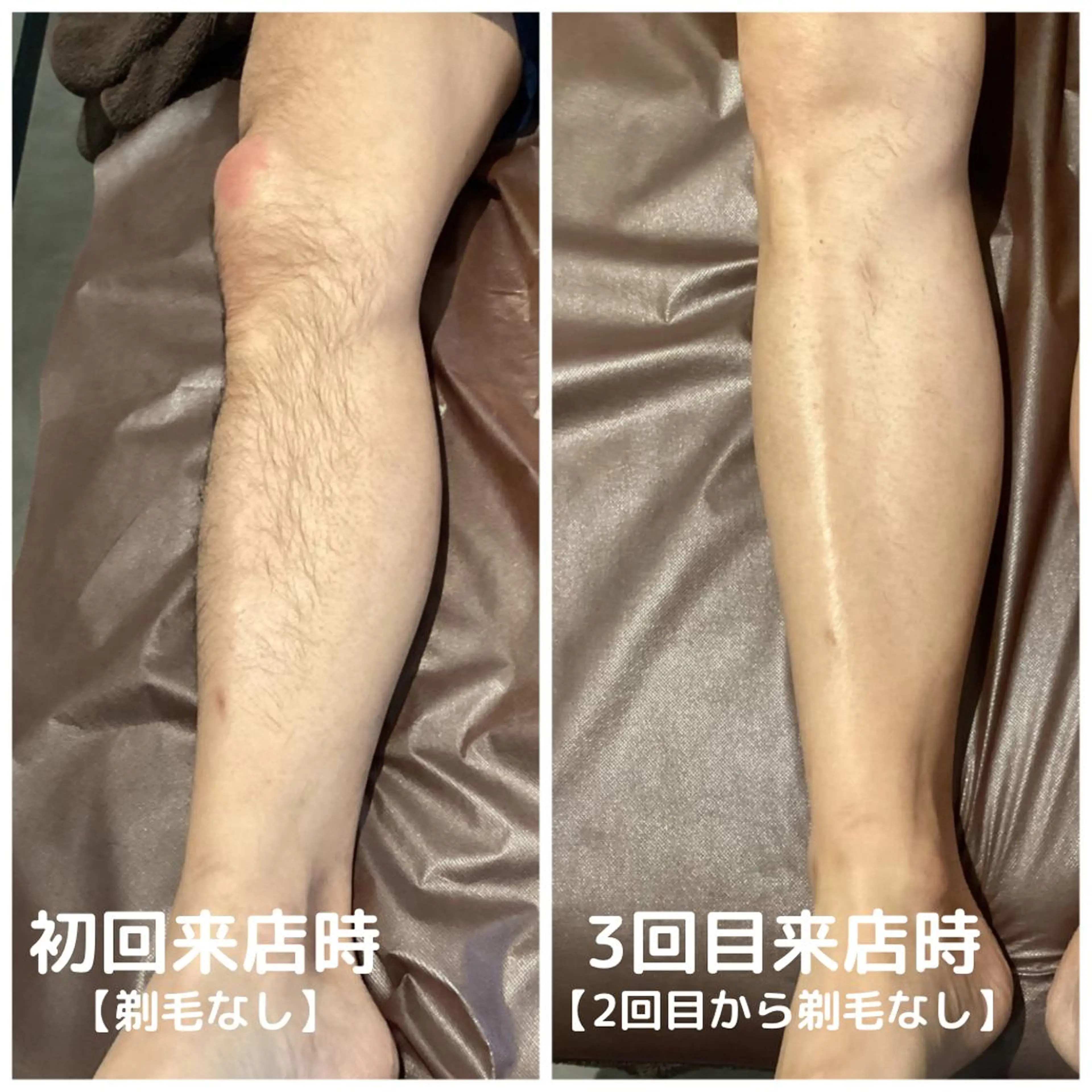 メンズ メンズ脱毛ECXIA所属・men's脱毛サロン ECXIAのエステ・リラクイメージ