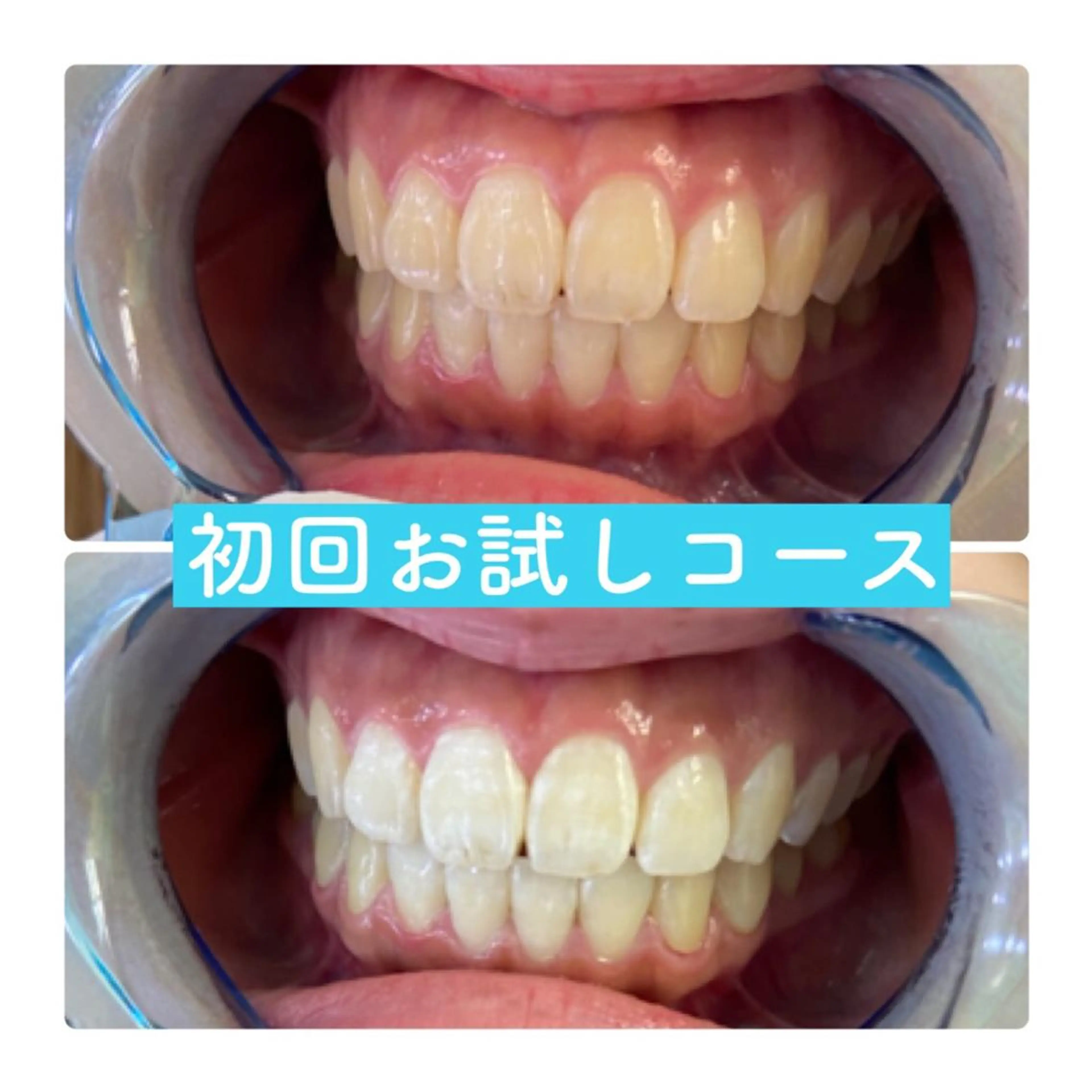 ホワイトニングルーム 横浜店のその他イメージ