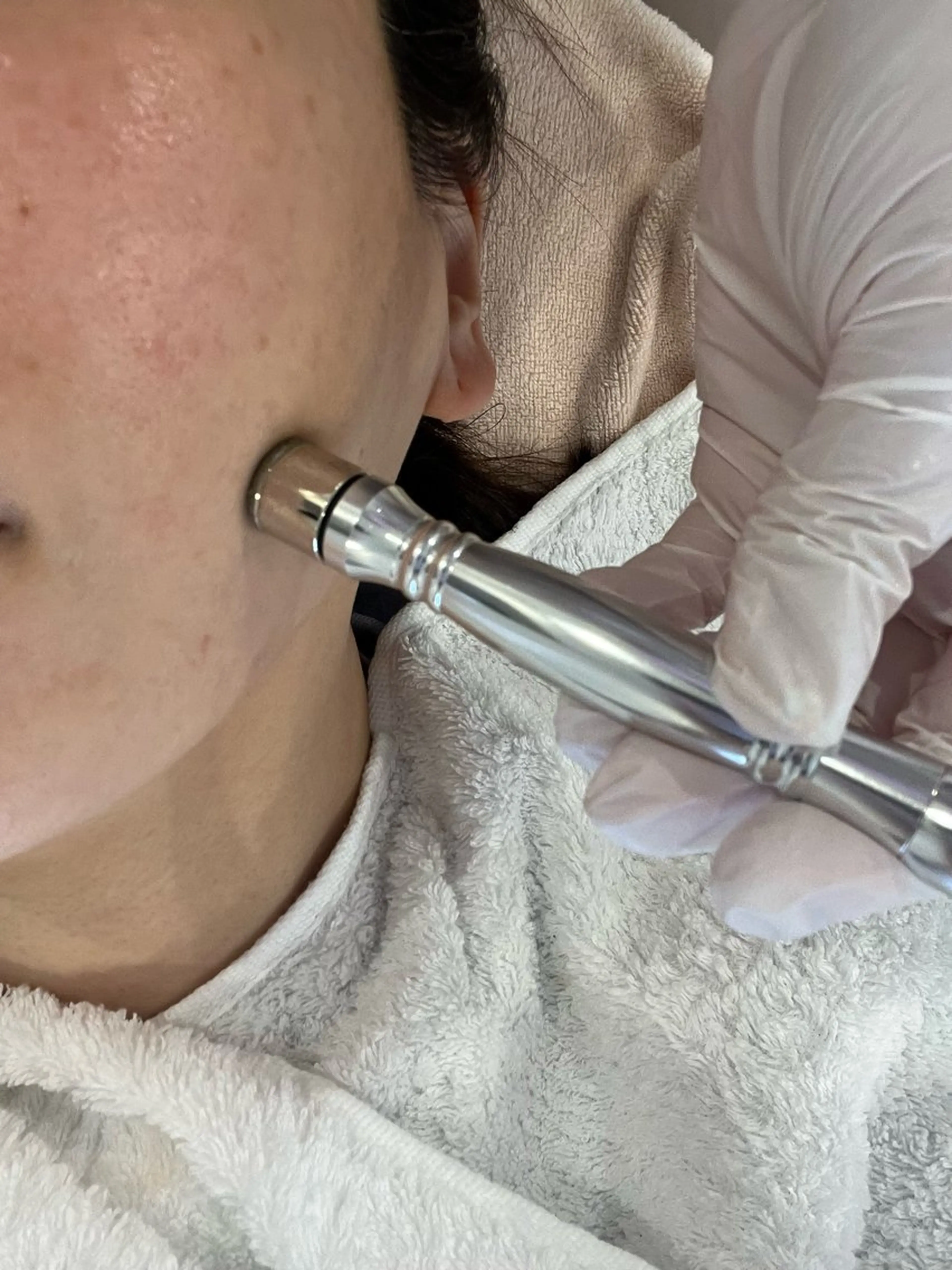 肌つやup 【角質除去/水光美肌】ダイヤモンドピール+LDM+冷却導入/小じわにもの写真