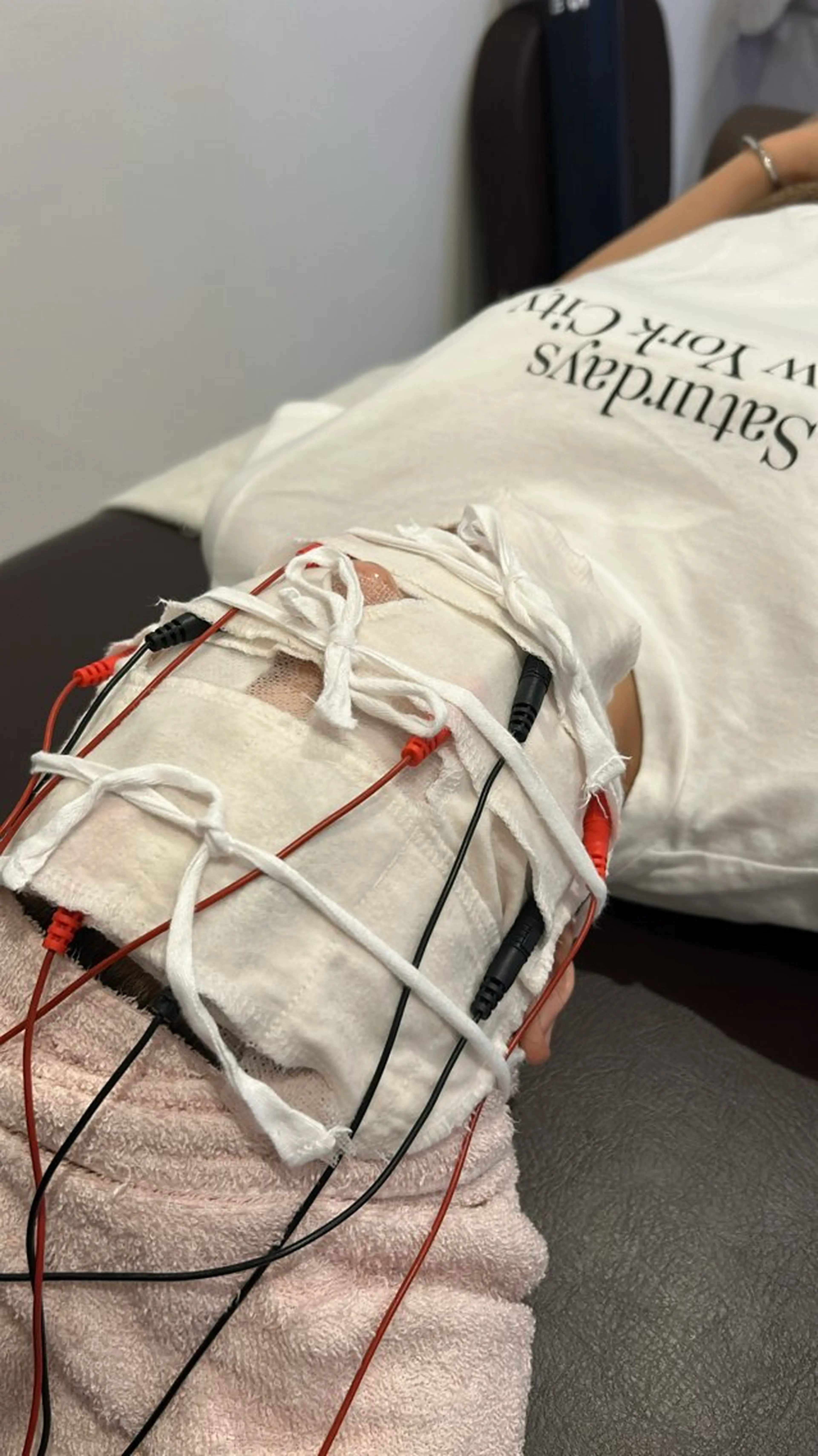 エステ リラク 美容鍼灸Solana所属・肌質改善×美容鍼 ゆいのエステ・リラクイメージ