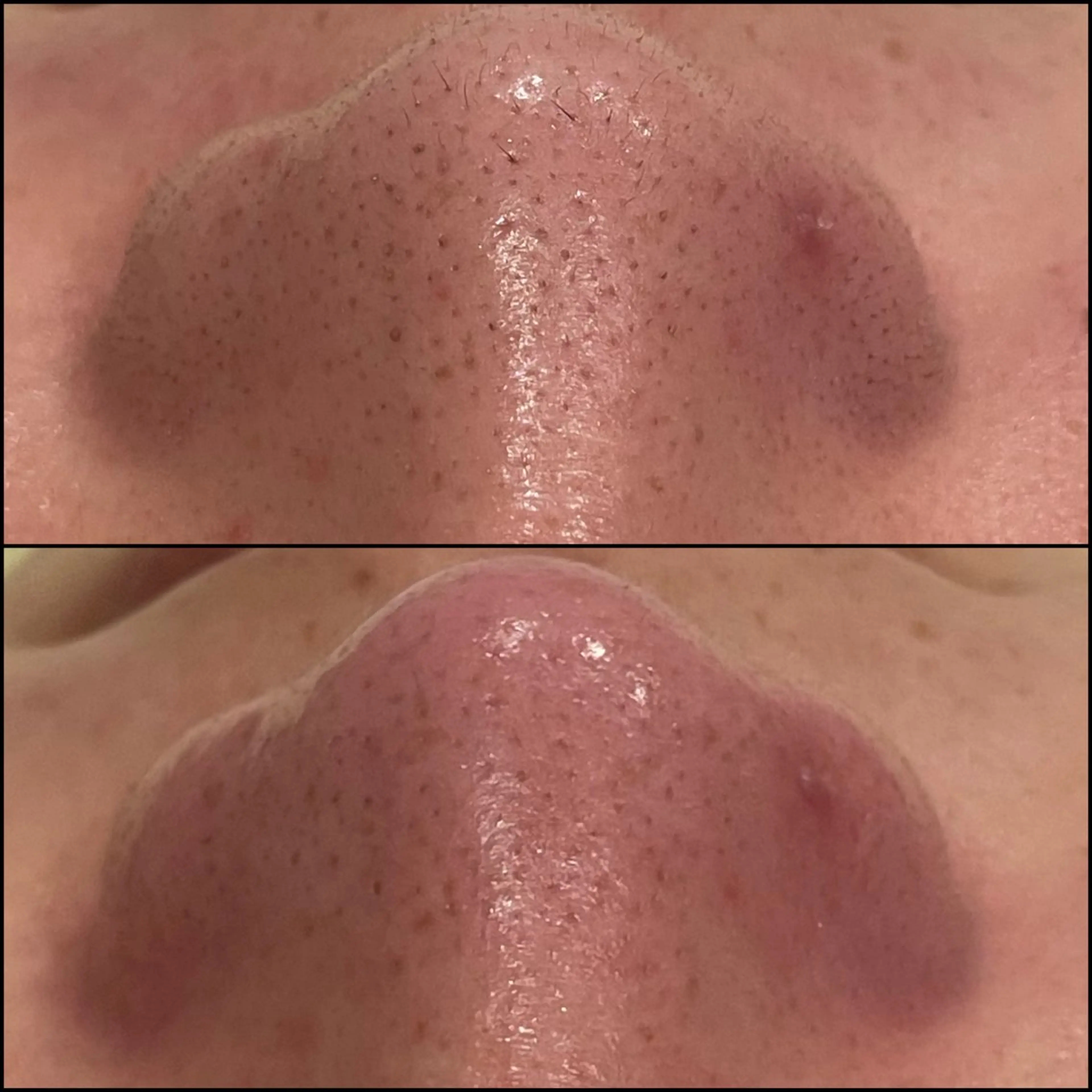 LiZA エステティックサロンのエステ・リラクイメージ