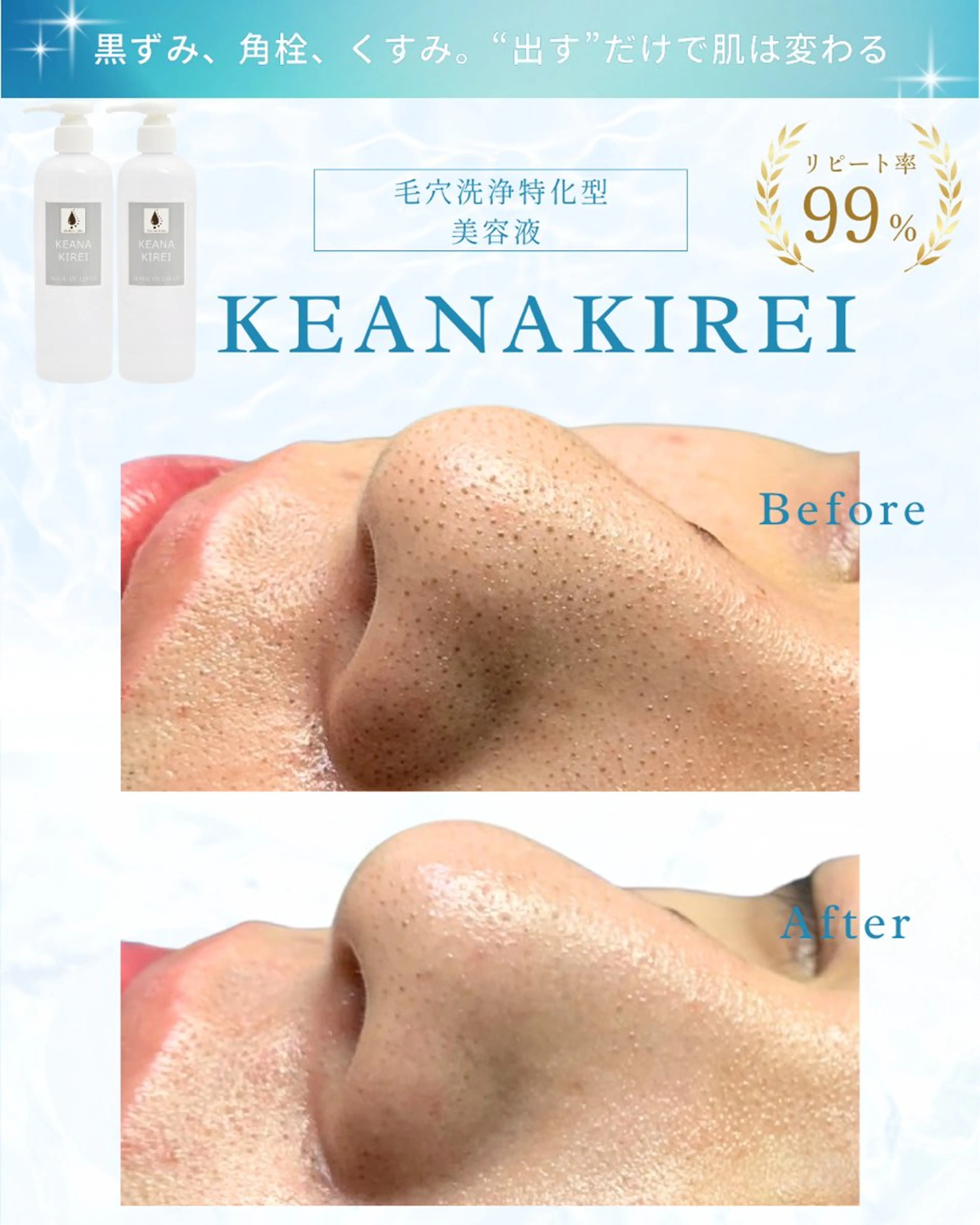 エステ LiAm《美肌管理/ 小顔/脂肪ケア》のその他イメージ