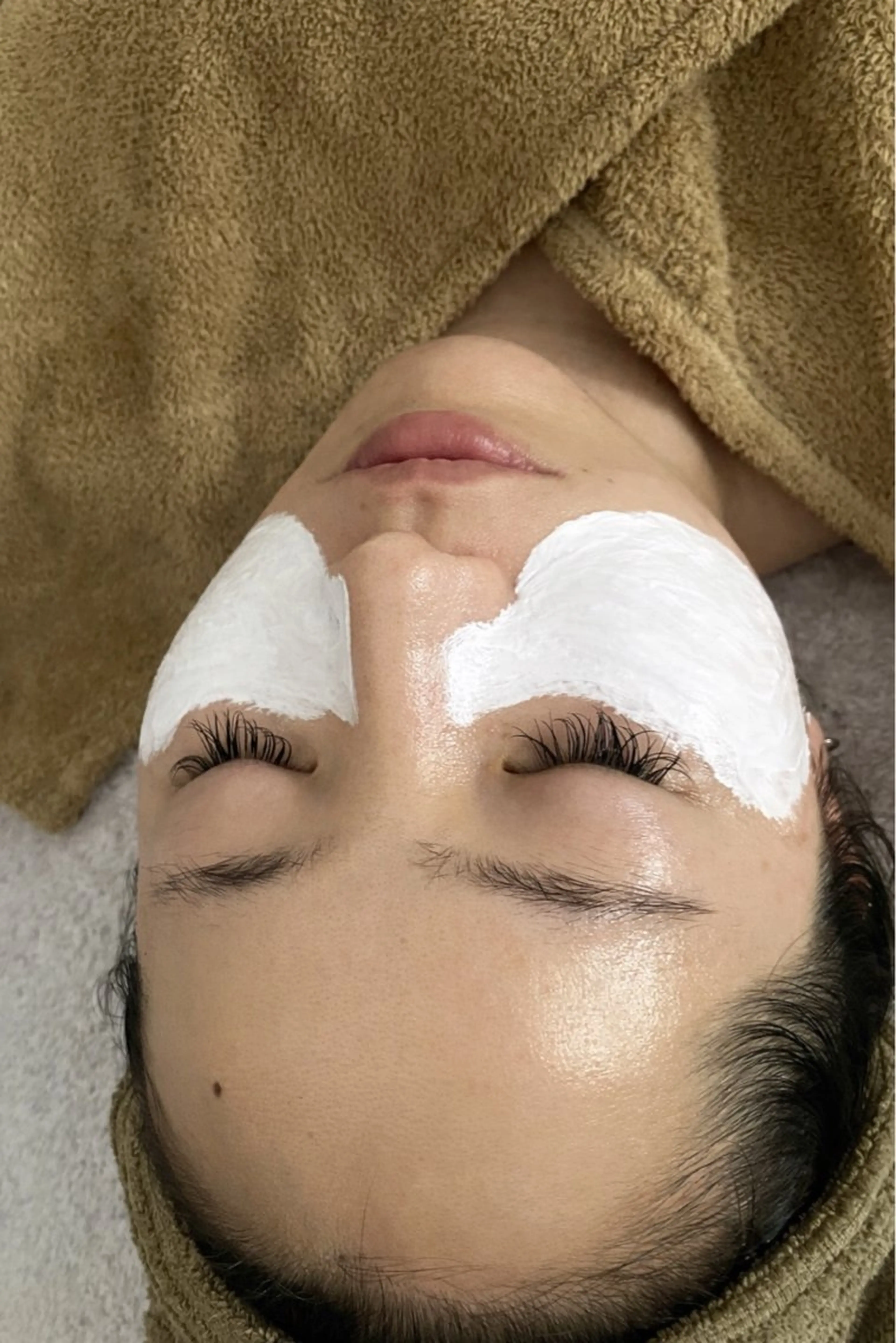 【胸元・首・お顔のエステ+頬の美白クリームパック】早めの紫外線ケアが鍵🔑美白クリームパック付きエステ♪の写真