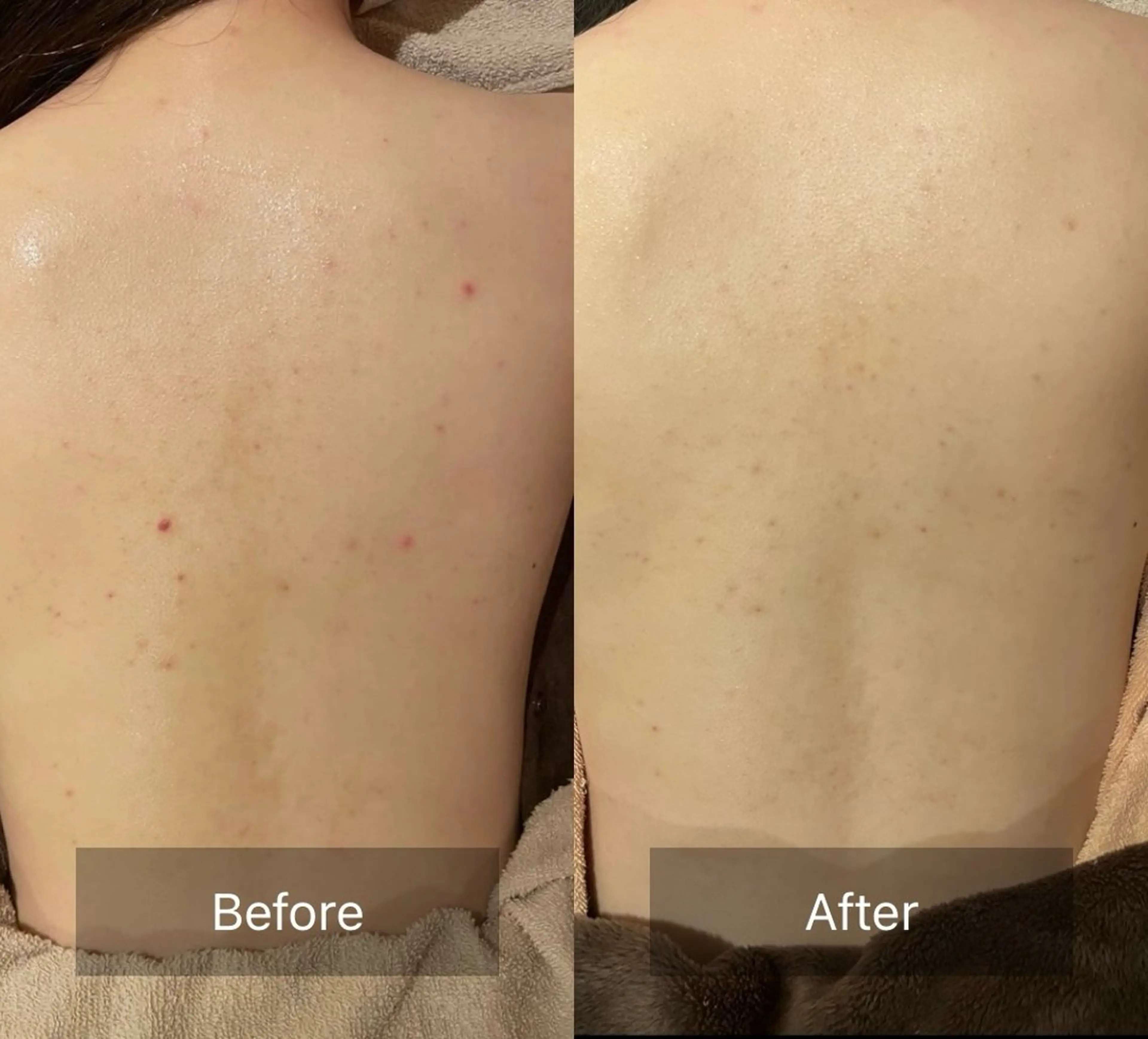 その他 for woman所属・森 美優のエステ・リラクイメージ