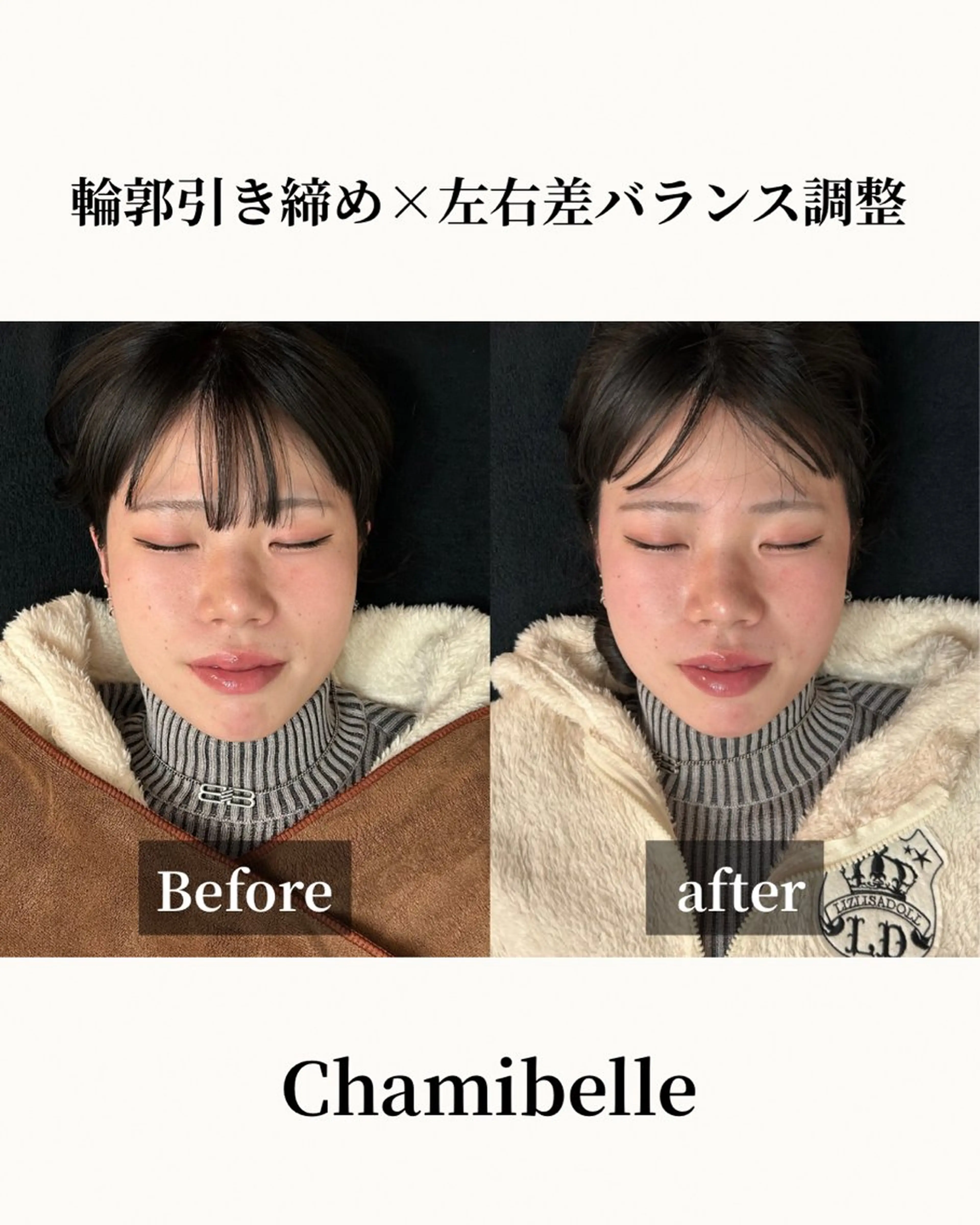 美容鍼灸サロン Chamibelleのエステ・リラクイメージ
