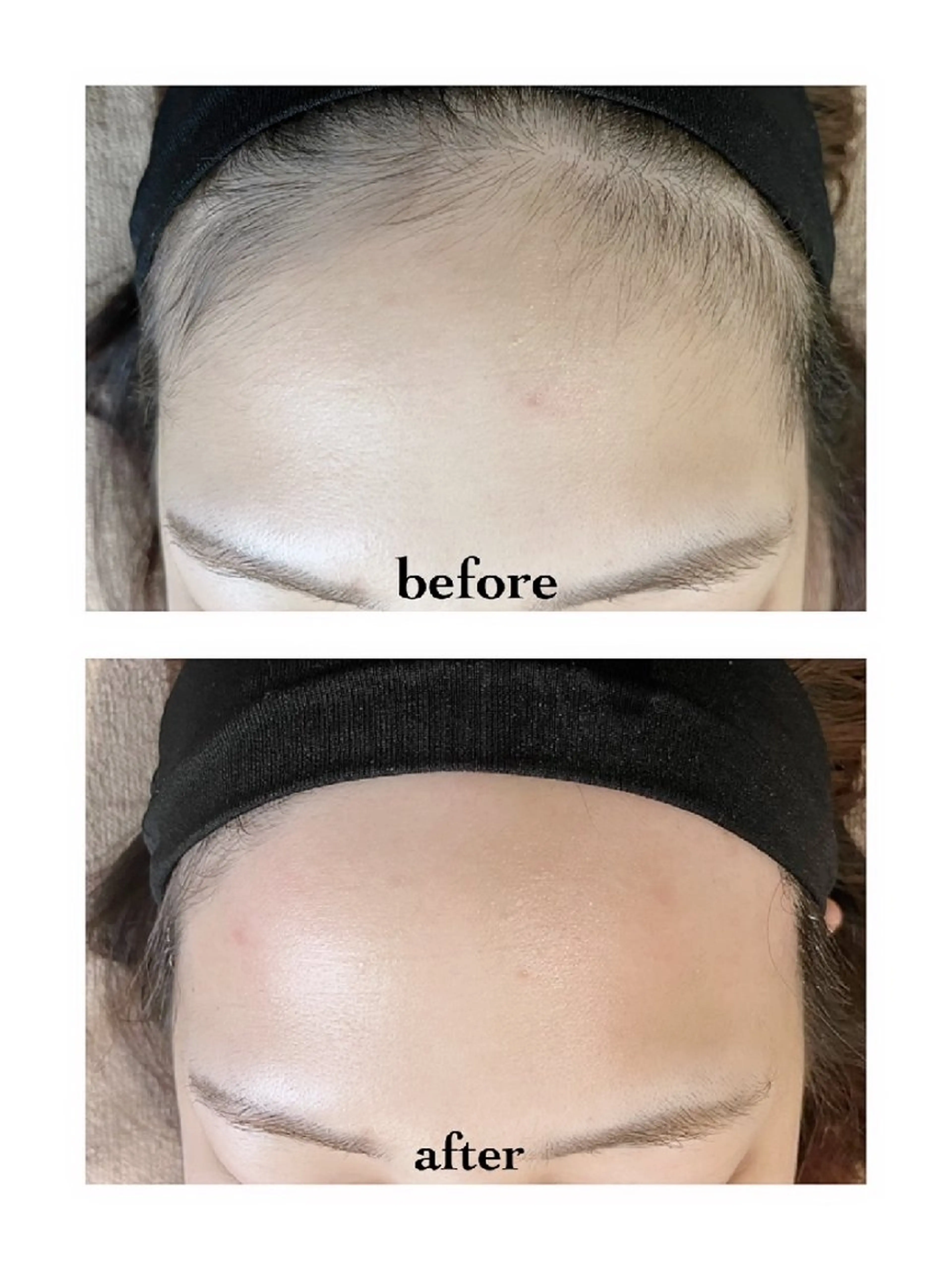 脱毛 douceknail所属・本厚木南口 徒歩3分のネイルデザイン