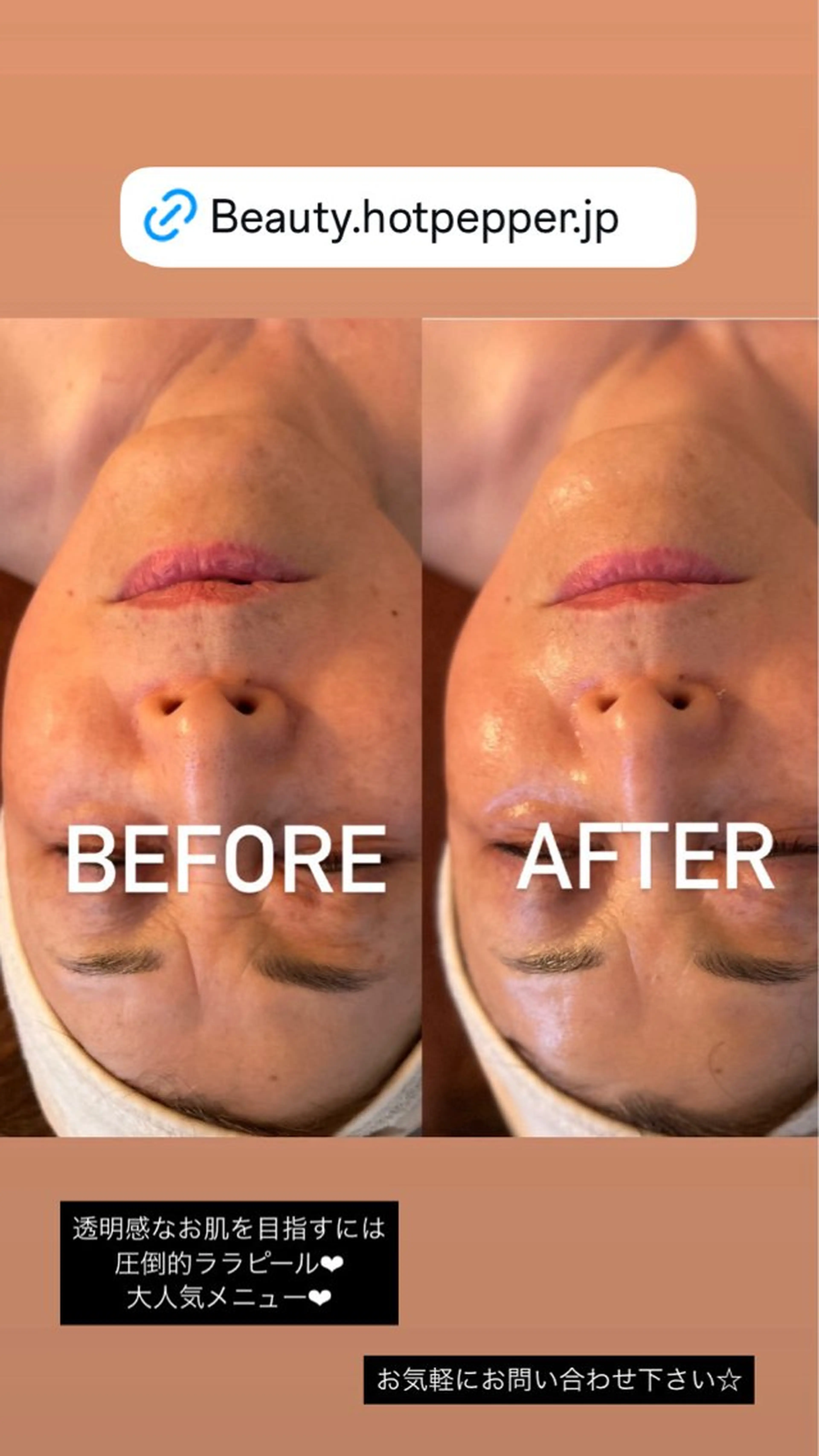 エステ VERY VERY 🌹九条店のエステ・リラクイメージ