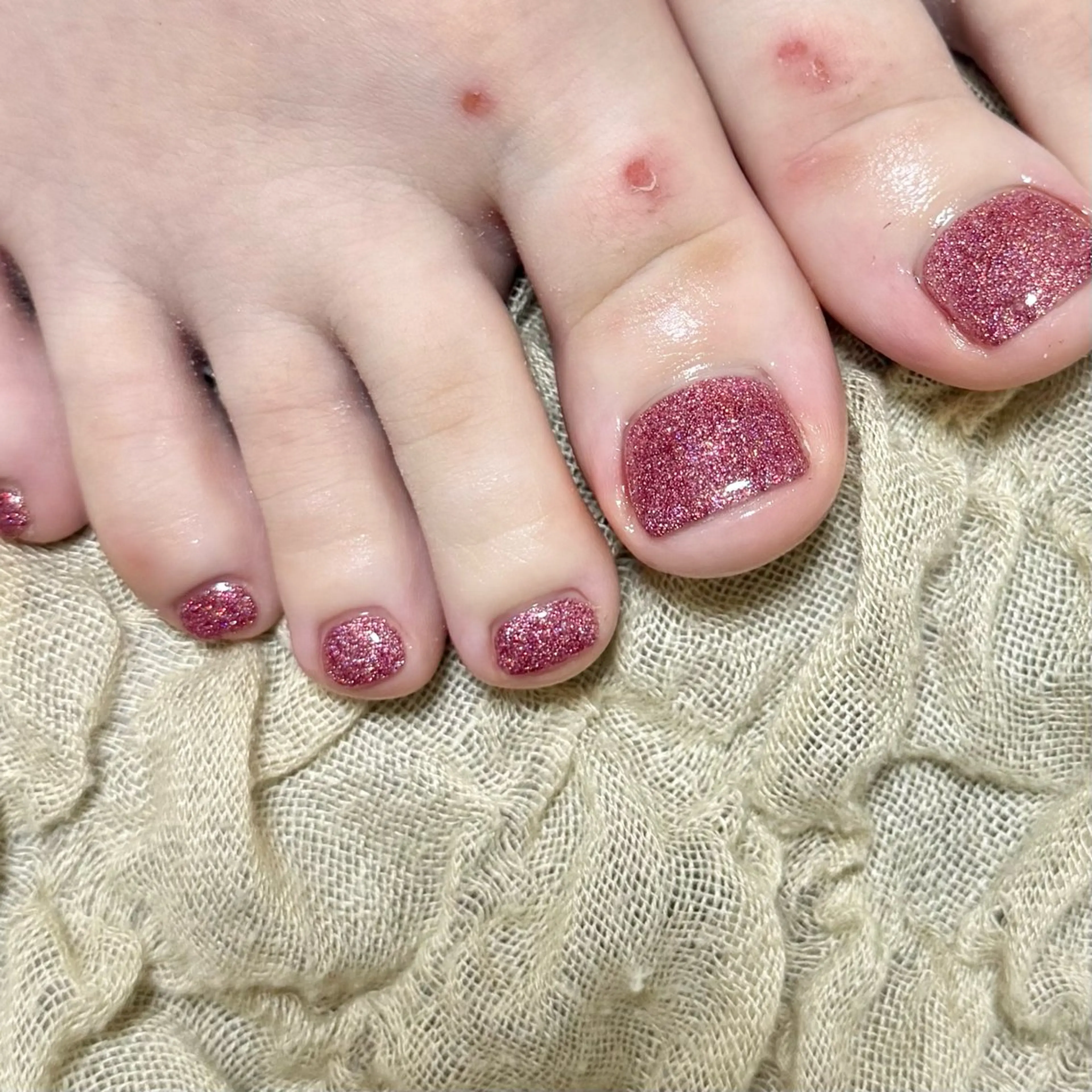 ネイル フットネイル are you nailのネイルデザイン