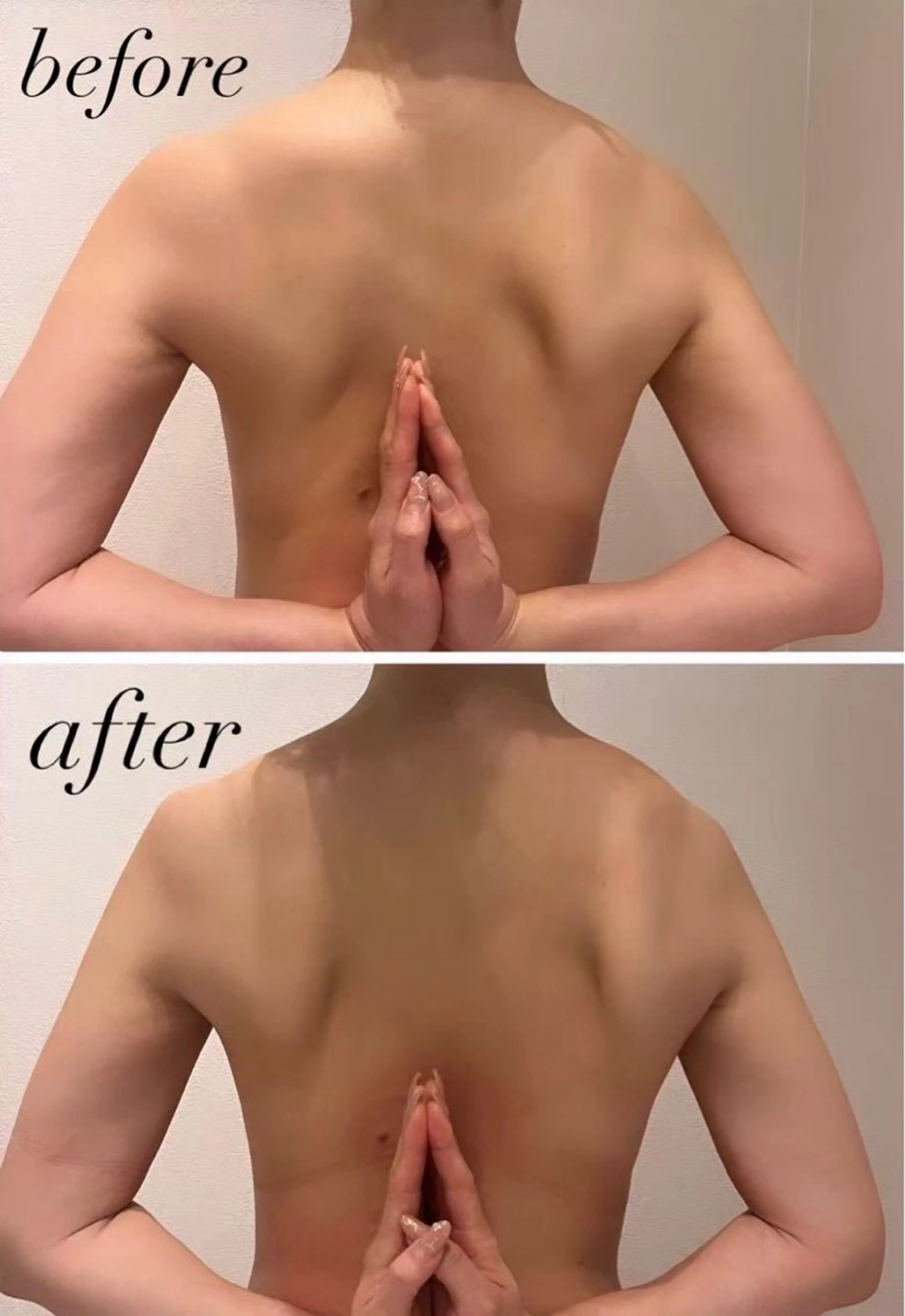 4月末までの期間限定！⭐️辛い肩こり、疲労回復に　　　　　　　　　深層筋膜リリースボディ30分　2900円の写真