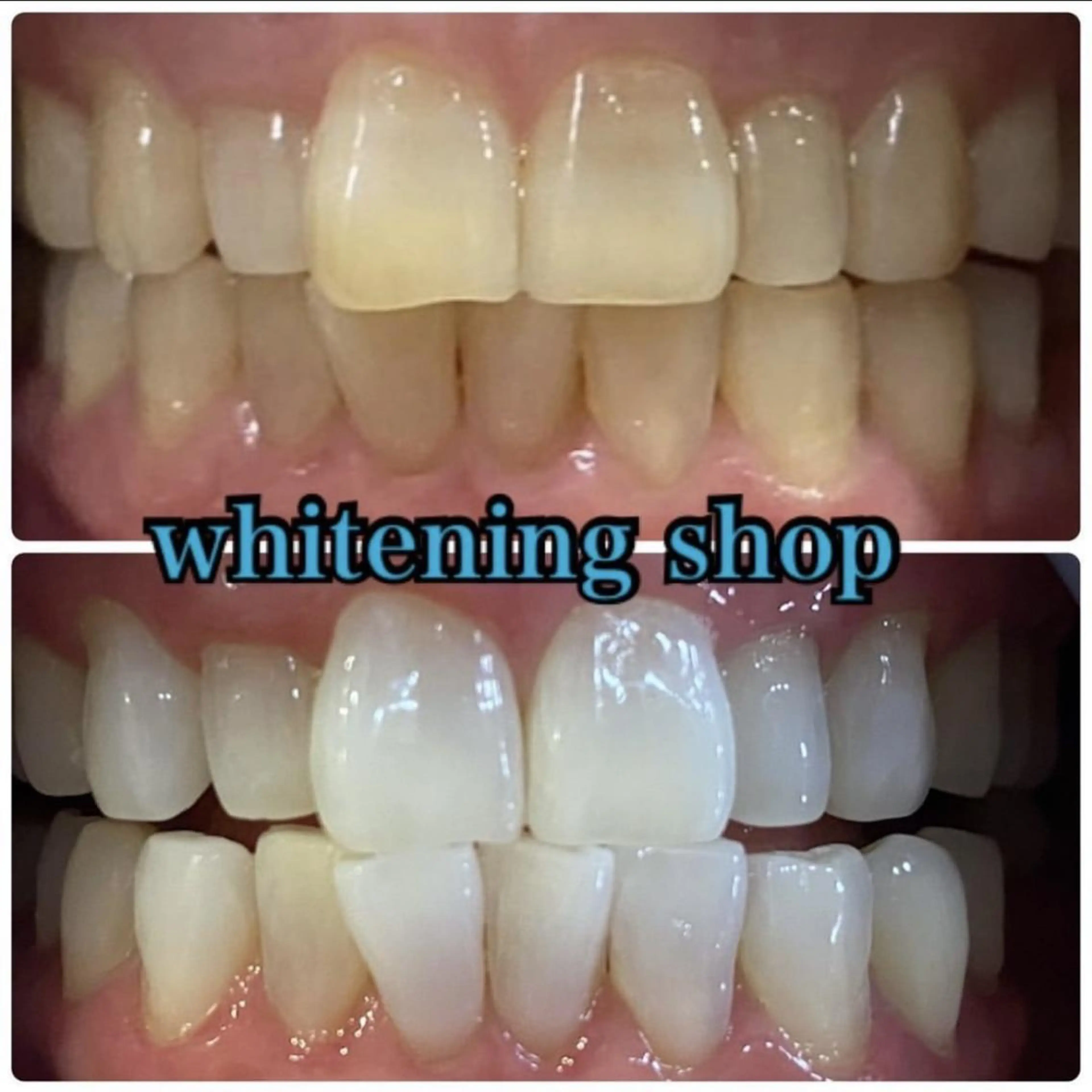 ホワイトニング ショップ千葉店のその他イメージ