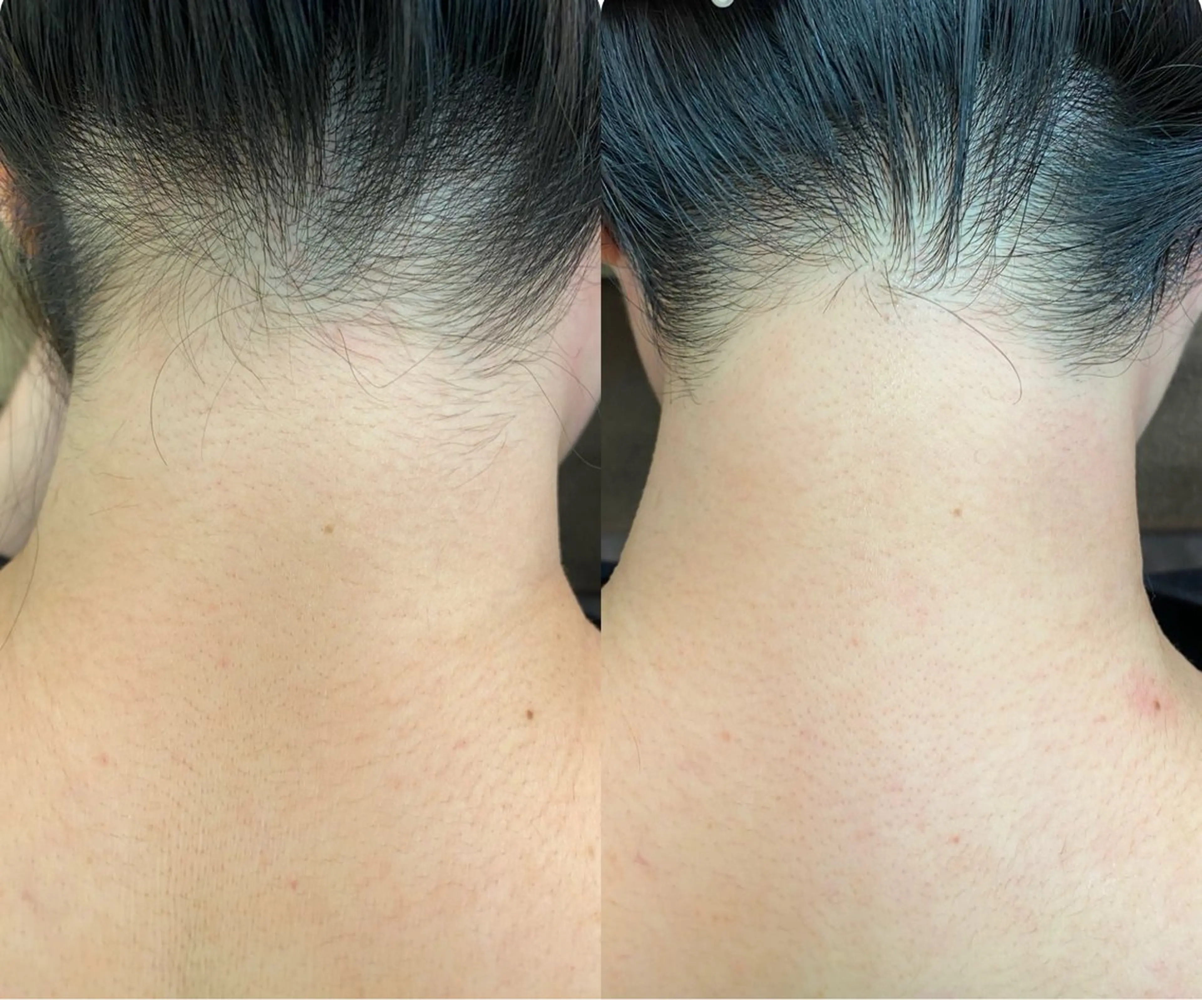 RE:moom リムーム/脱毛エステのエステ・リラクイメージ