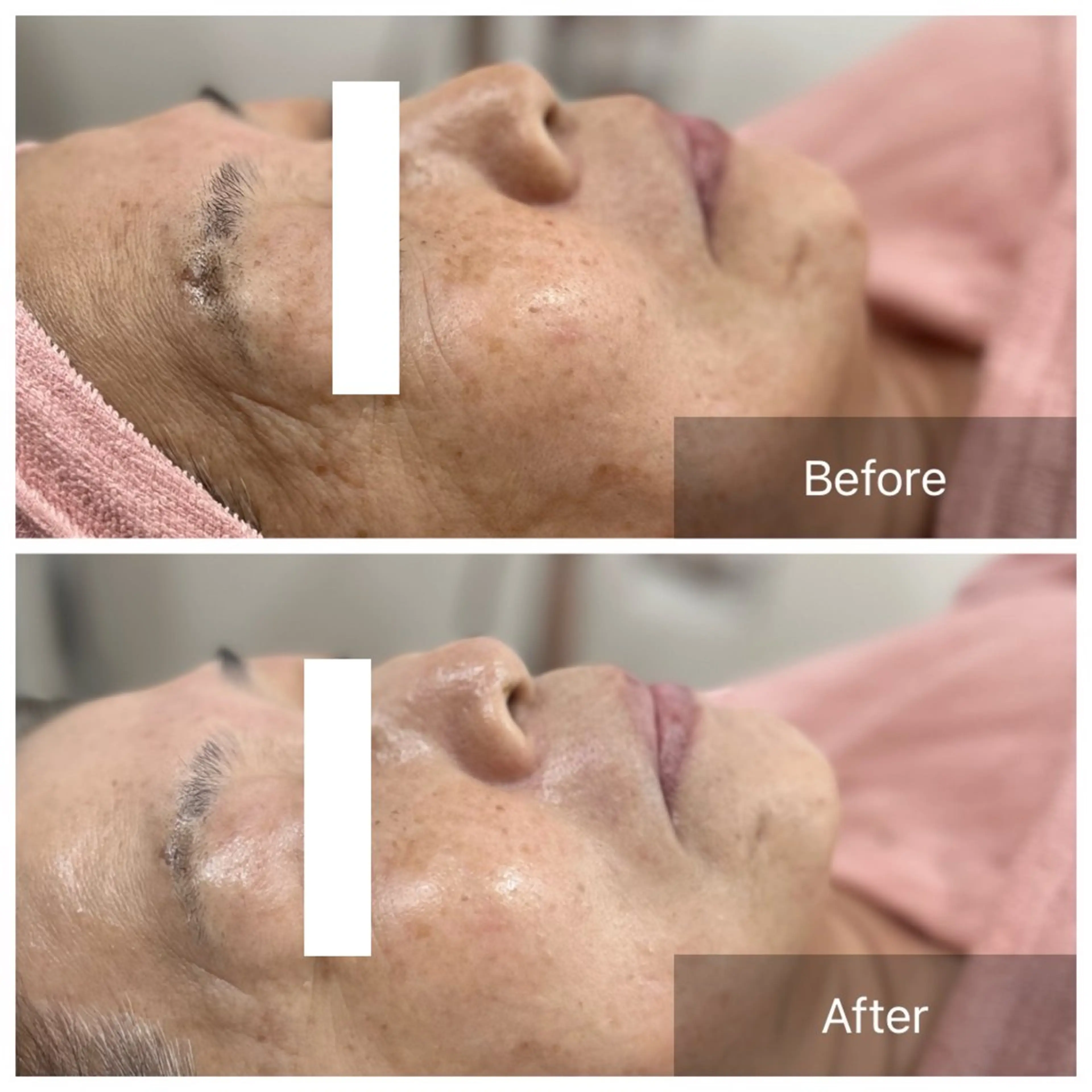 【現役看護師】高来 笑子のエステ・リラクイメージ