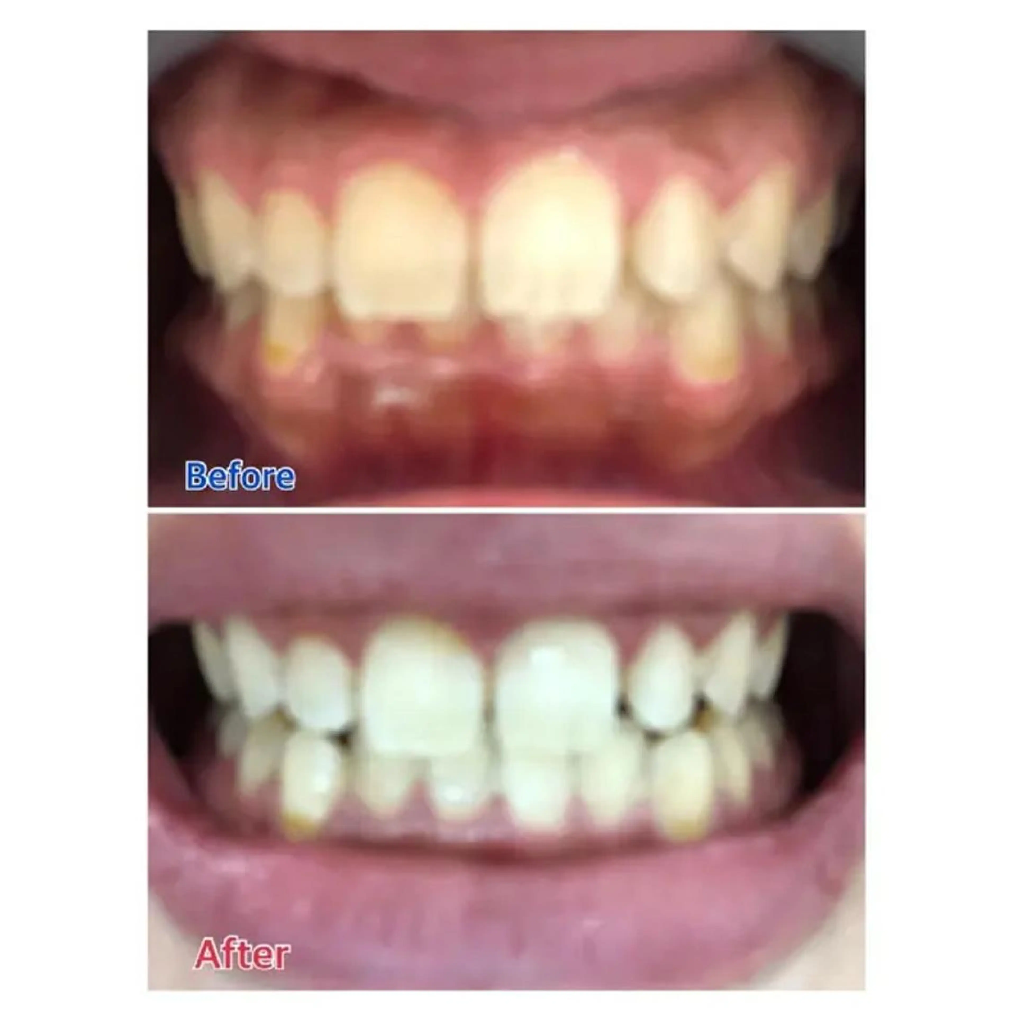 Ｍ渋谷 ホワイトニングのエステ・リラクイメージ