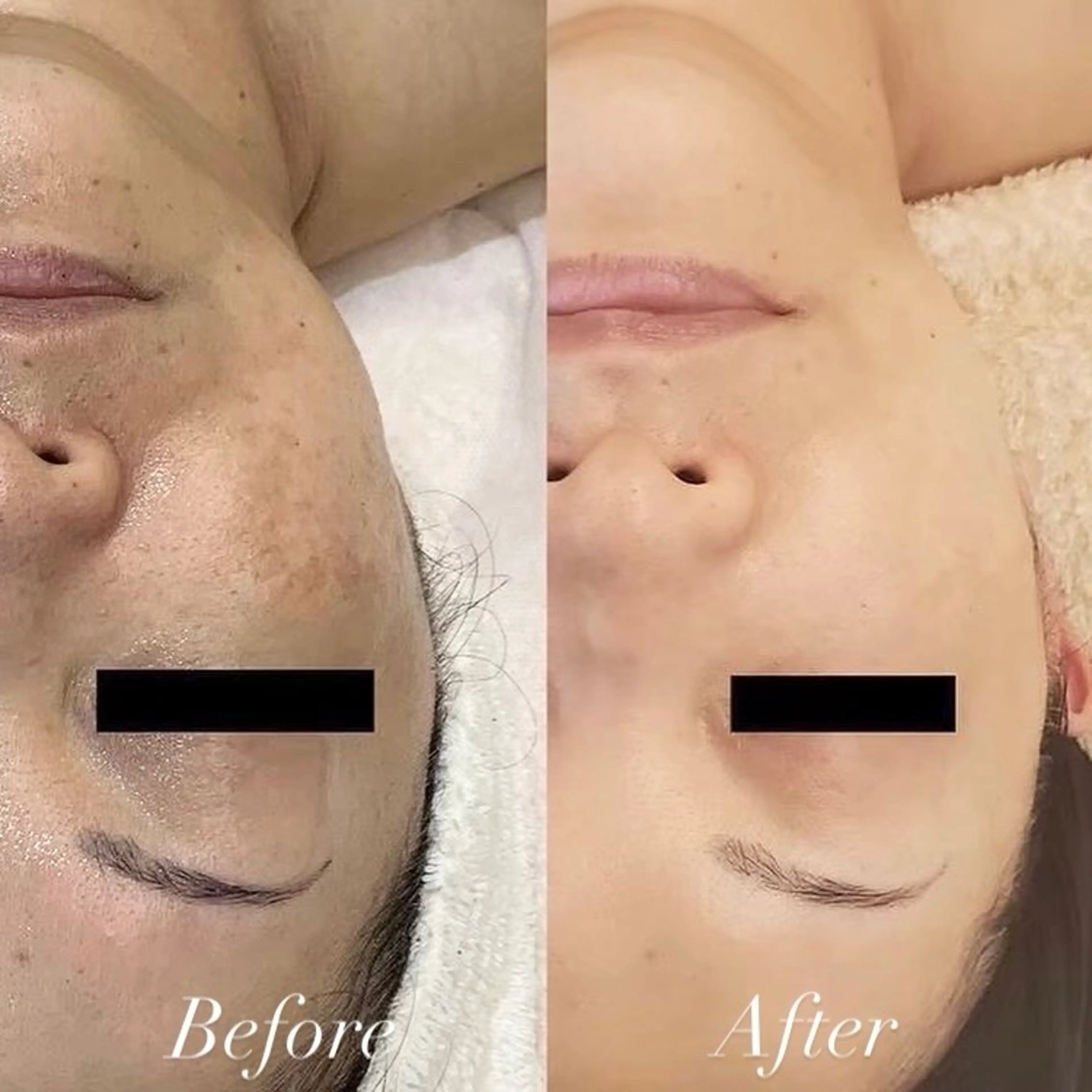 エステ 綺麗のひみつ グランプリ受賞店のエステ・リラクイメージ