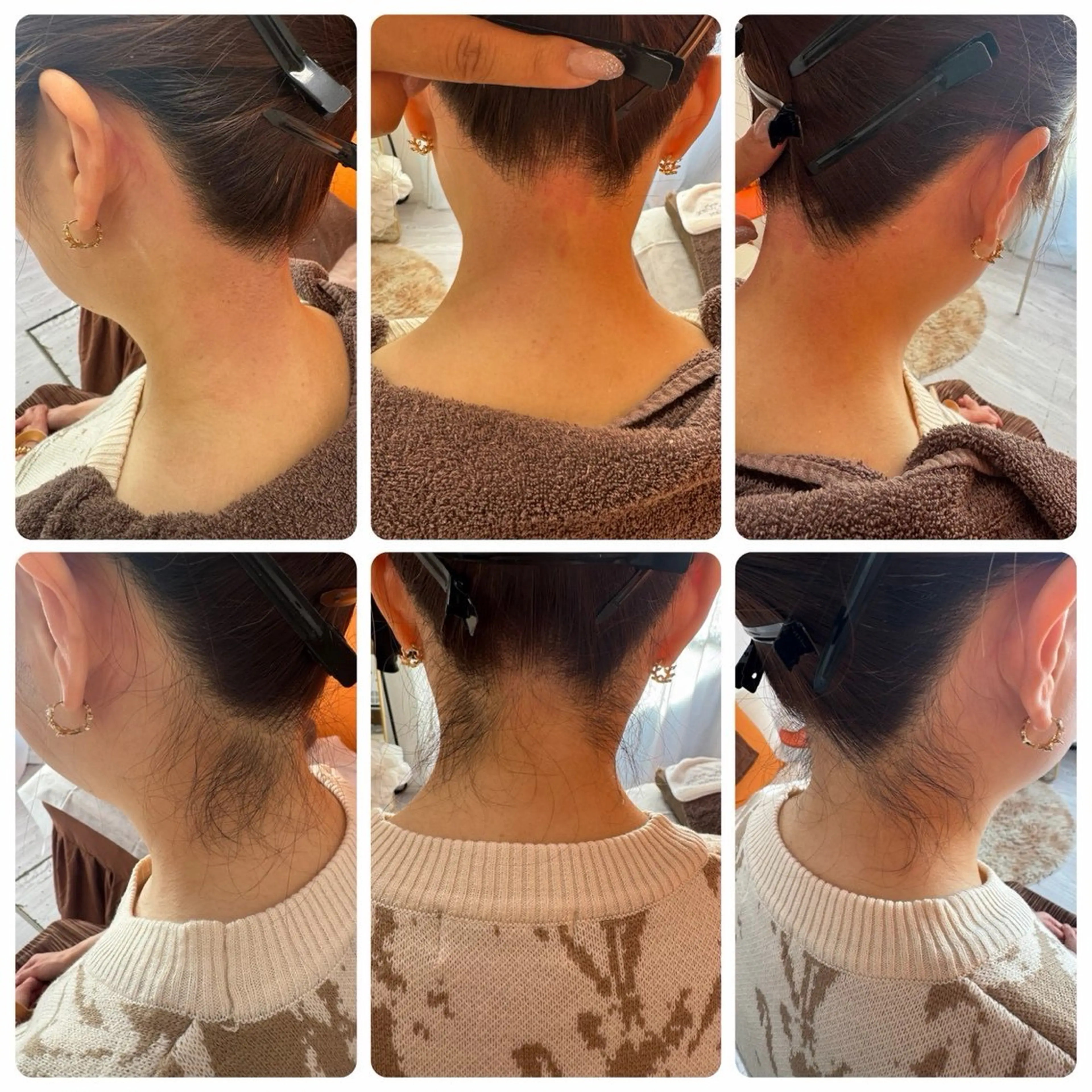 脱毛 Vonita Mikieのエステ・リラクイメージ