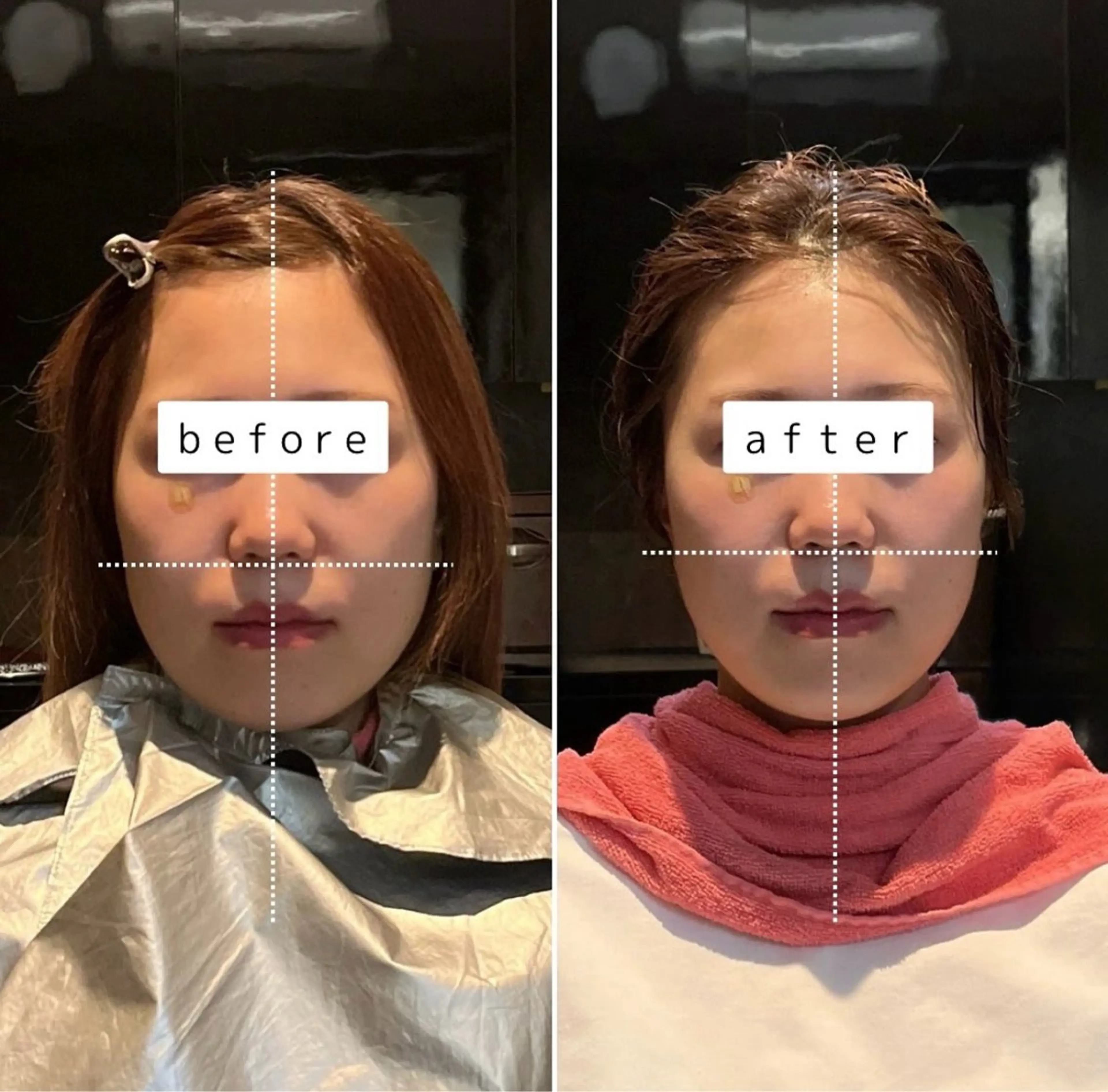 小顔矯正/ヘッドスパ /Arieのエステ・リラクイメージ