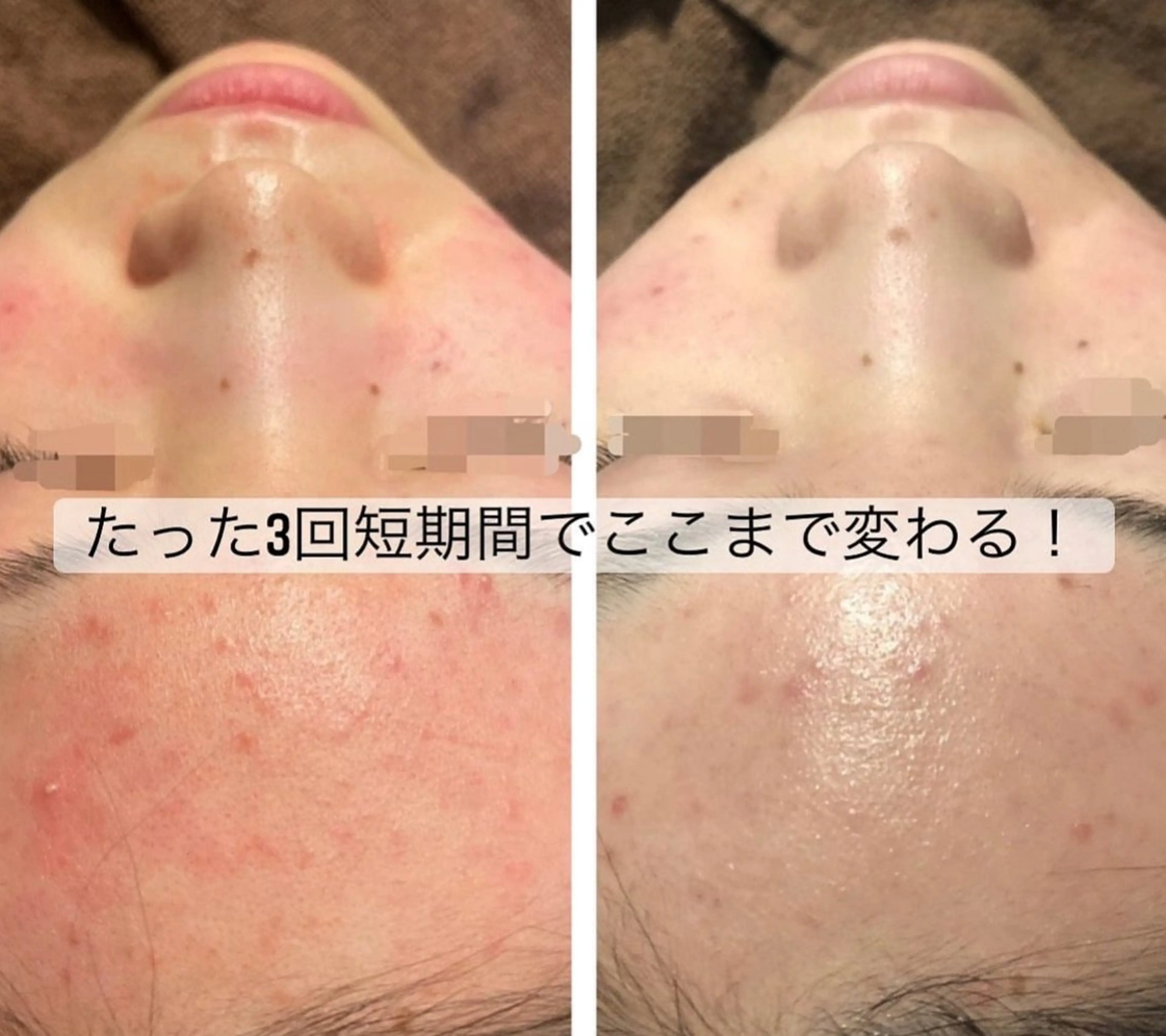 エステ ハーブ&艶肌ワックス re:proのエステ・リラクイメージ