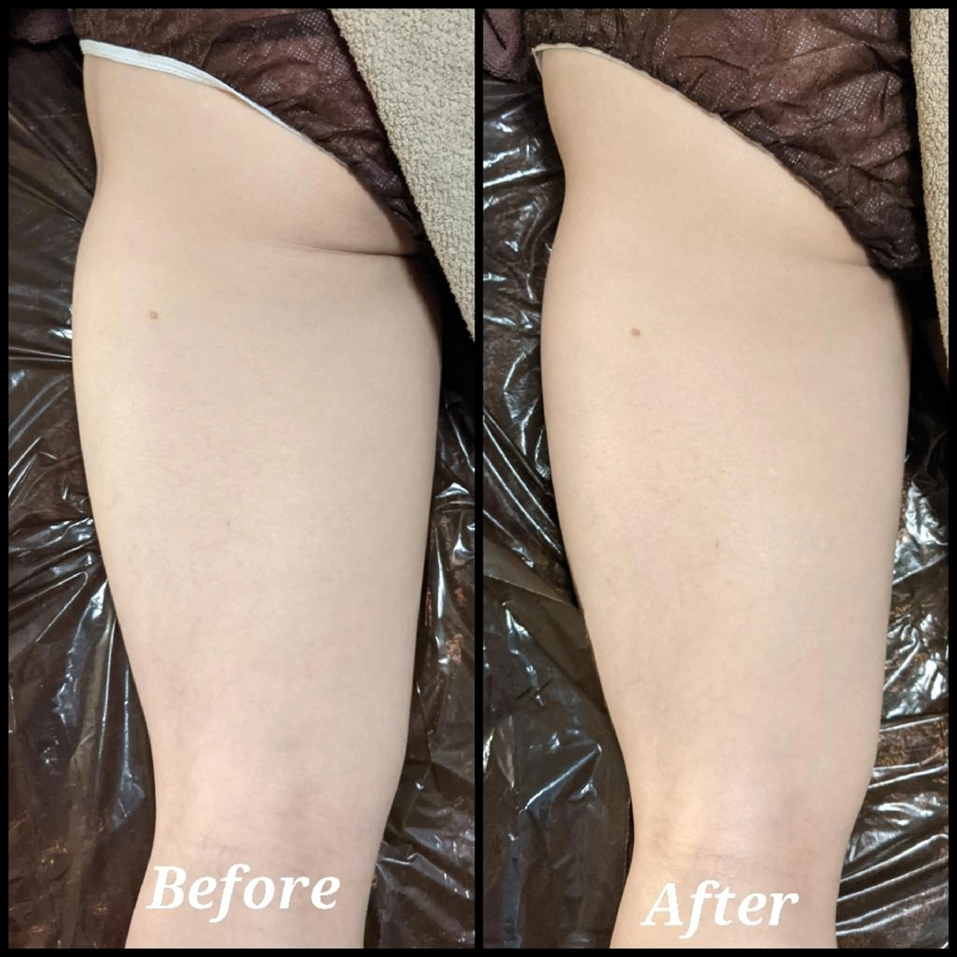 深層リンパオイル/小 顔とドライヘッドスパのエステ・リラクイメージ