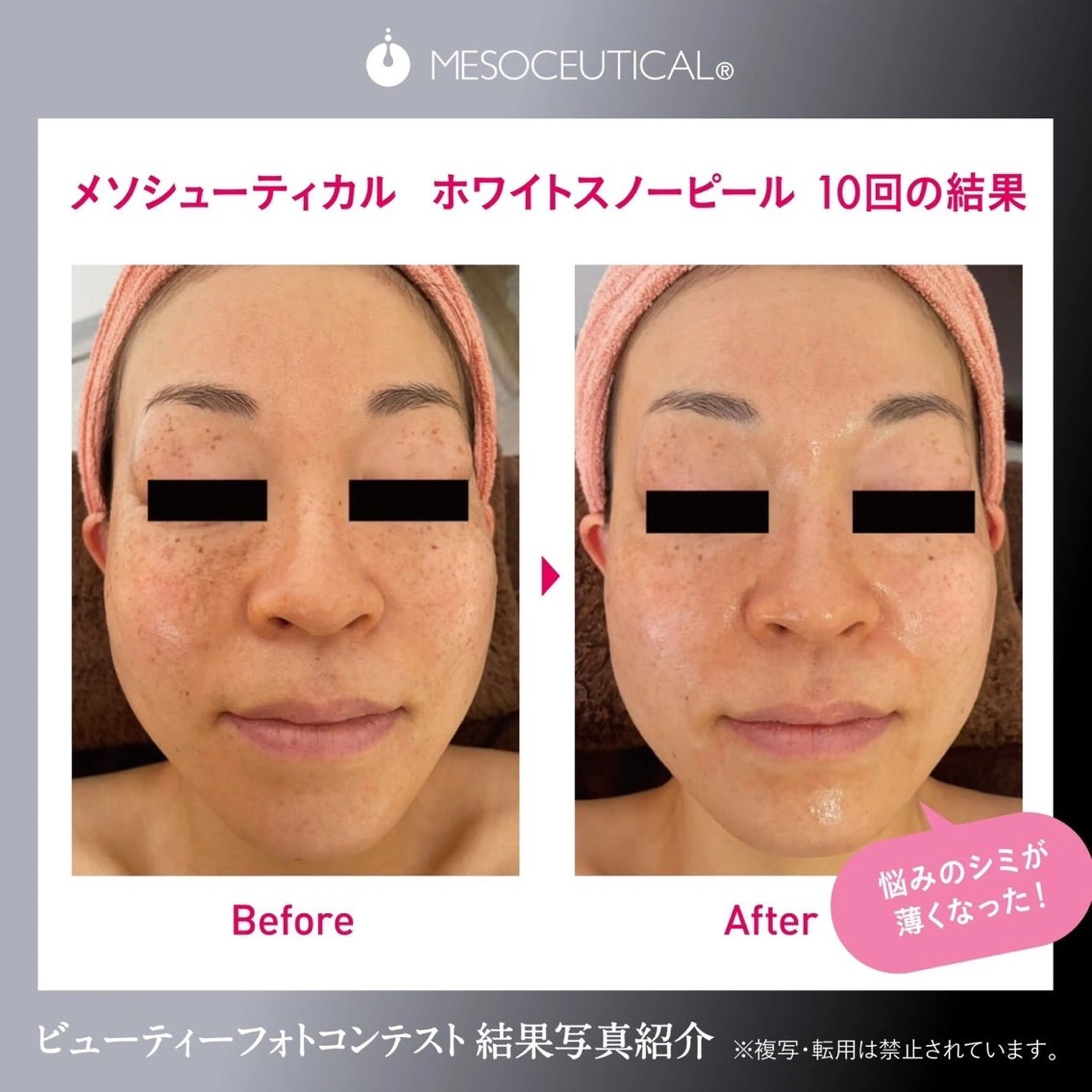 毛穴のお悩み・シミ 松本瞳のエステ・リラクイメージ