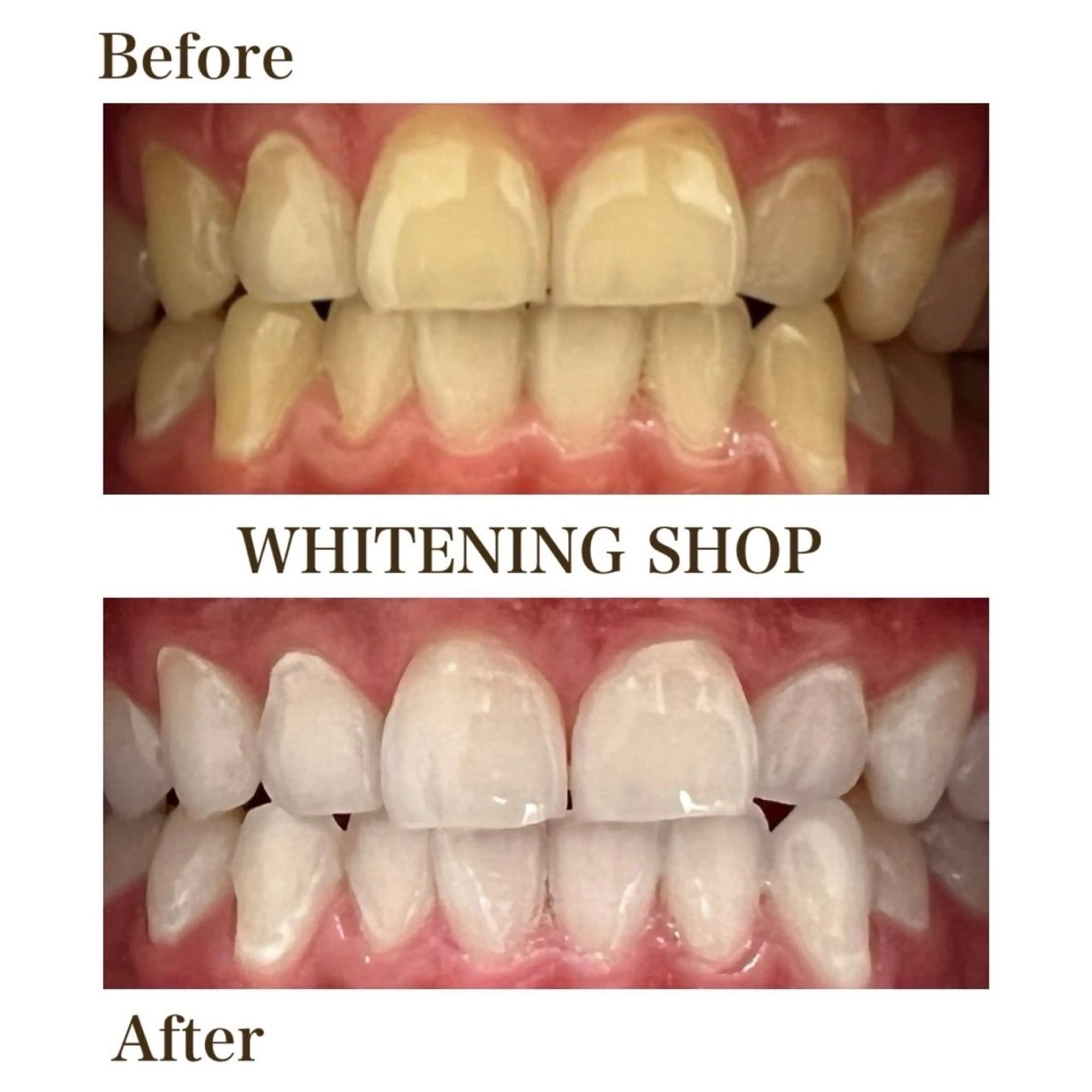 ホワイトニングショップ津店所属・ホワイトニング ショップ津店のその他イメージ