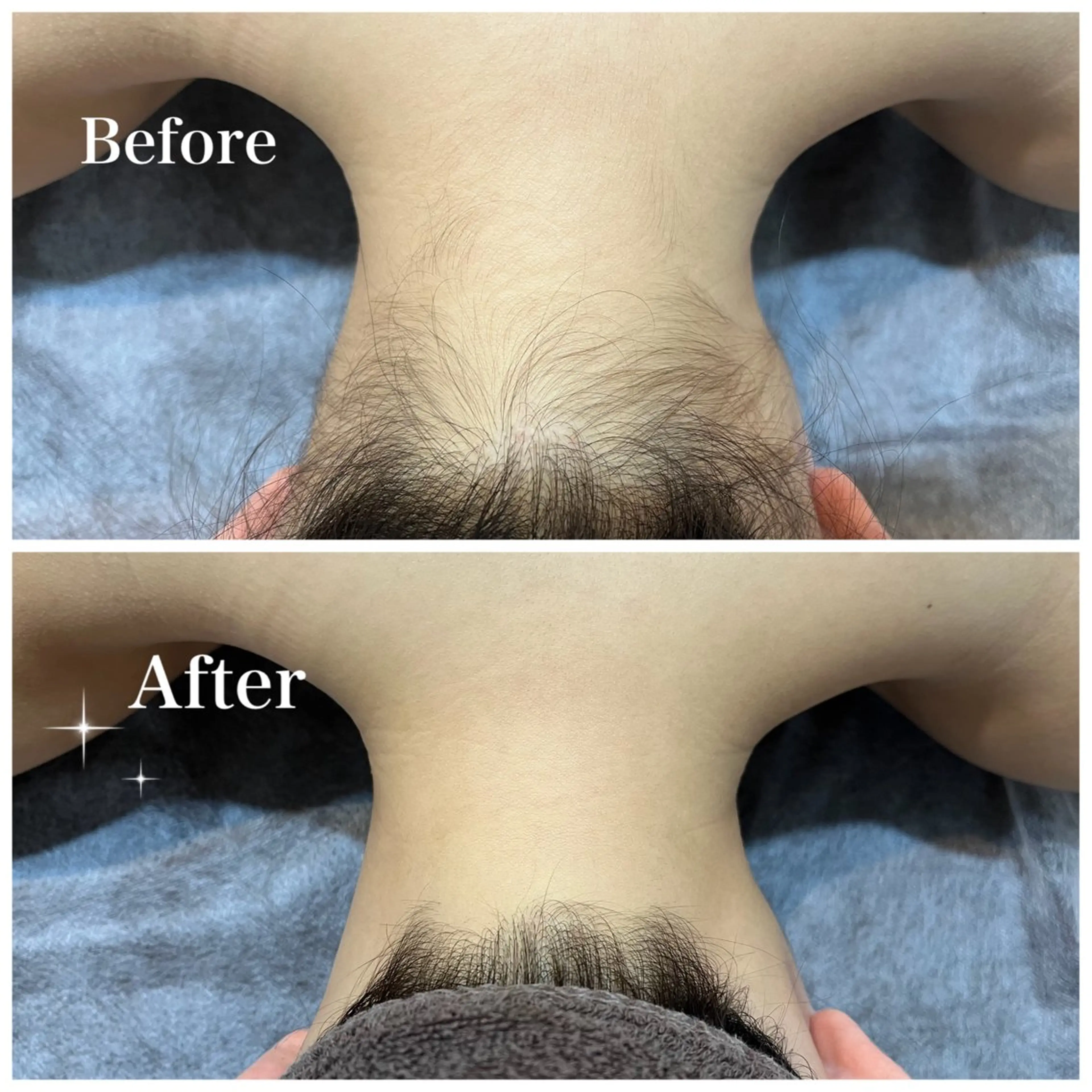 脱毛 脱毛サロン fam.豊澤柚良のエステ・リラクイメージ