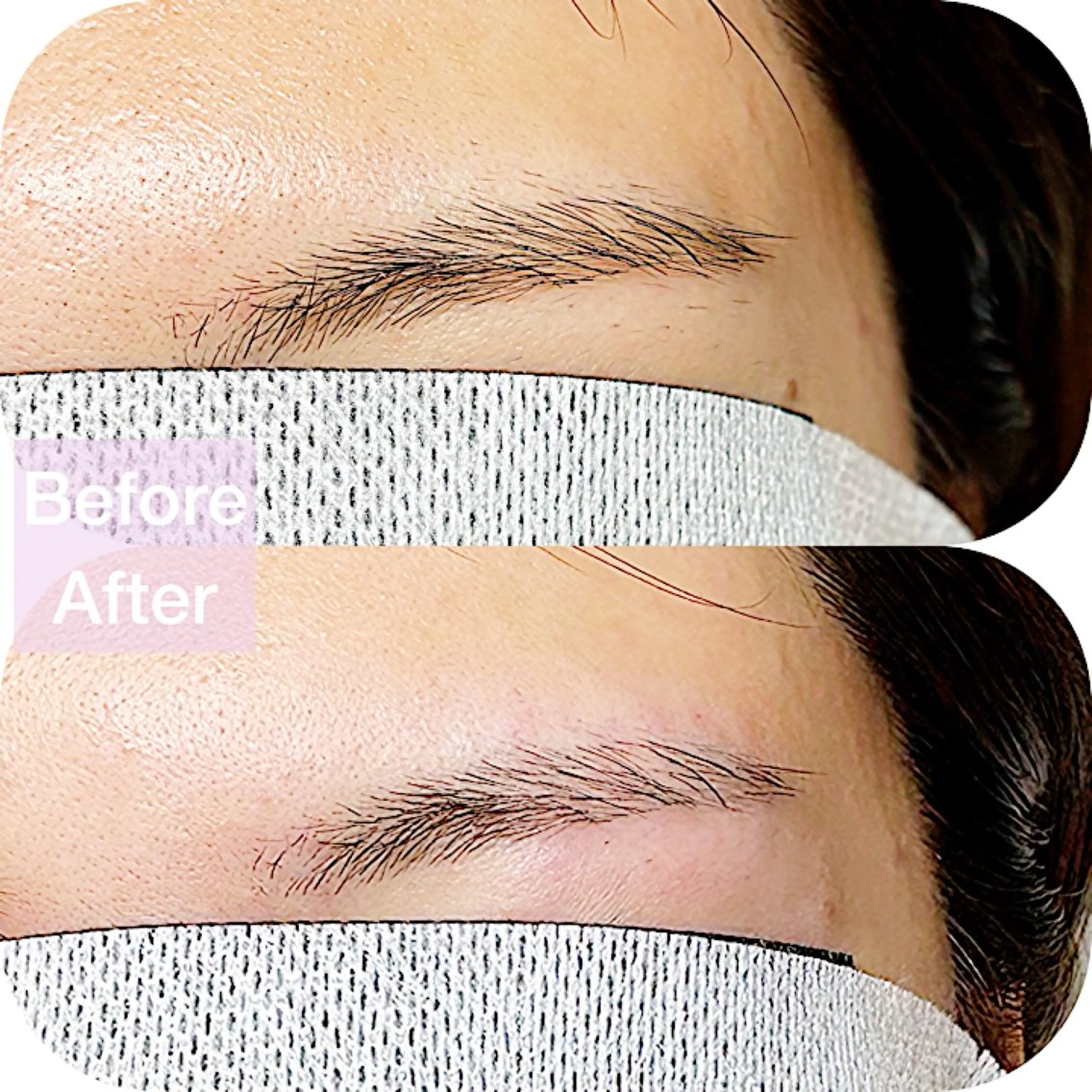 アイブロウ 眉毛ワックス脱毛 【一本ずつ脱毛】 ReMove 柏のエステ・リラクイメージ