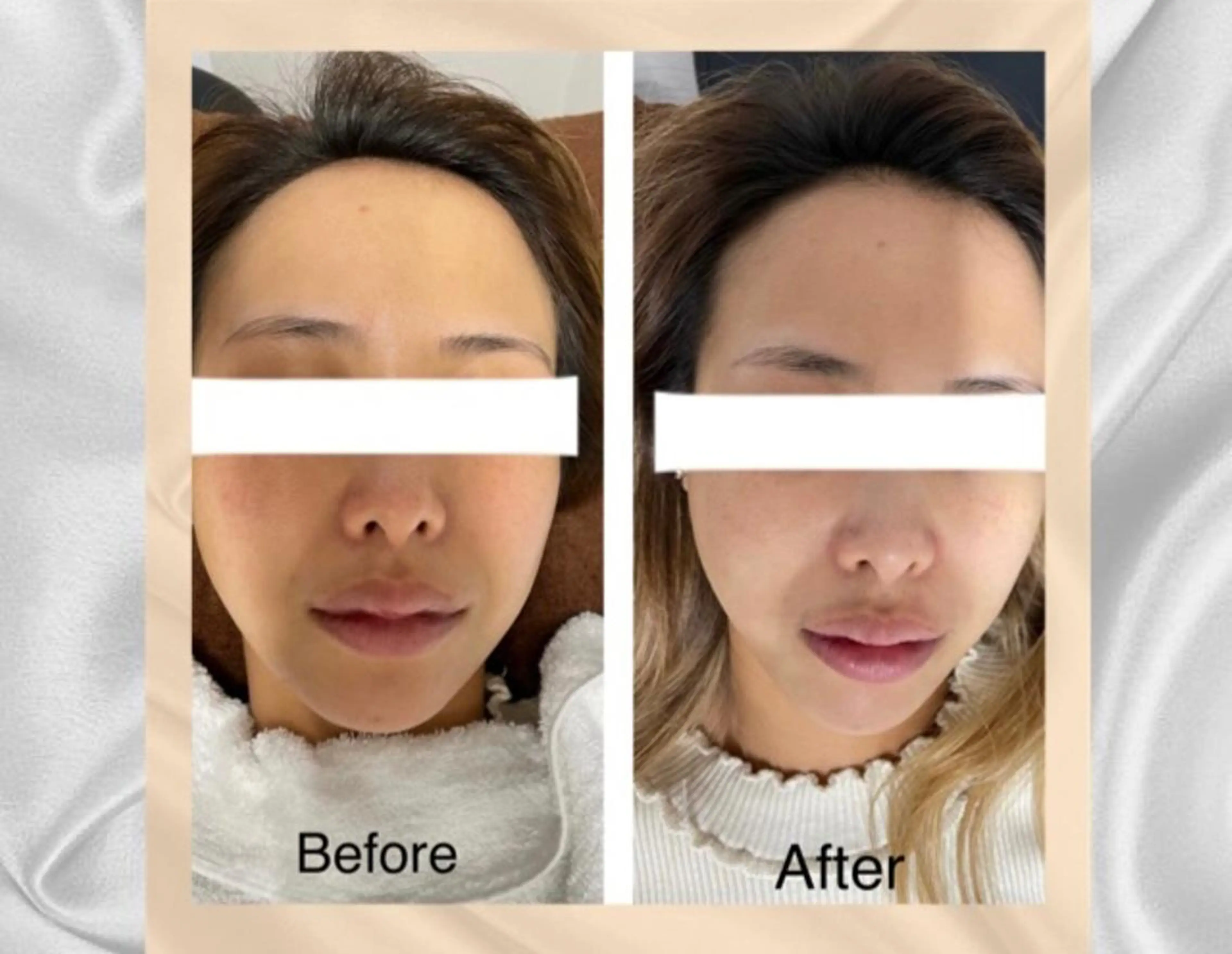 ENCHANT 脱毛.小顔.毛穴のエステ・リラクイメージ