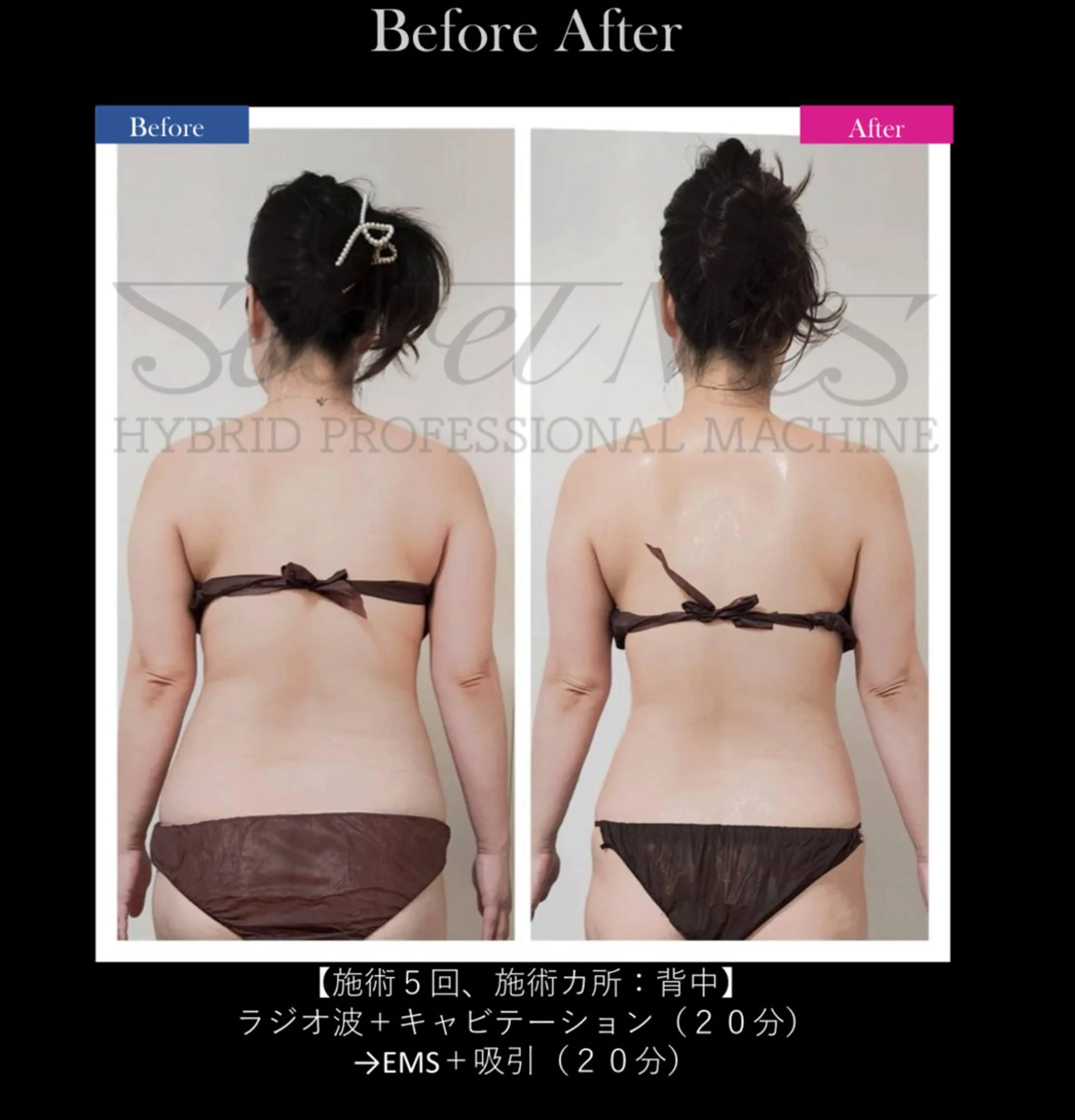 Secret Mesで全身シェイプ！全身スリムコース120分　メンズOK‼︎の写真