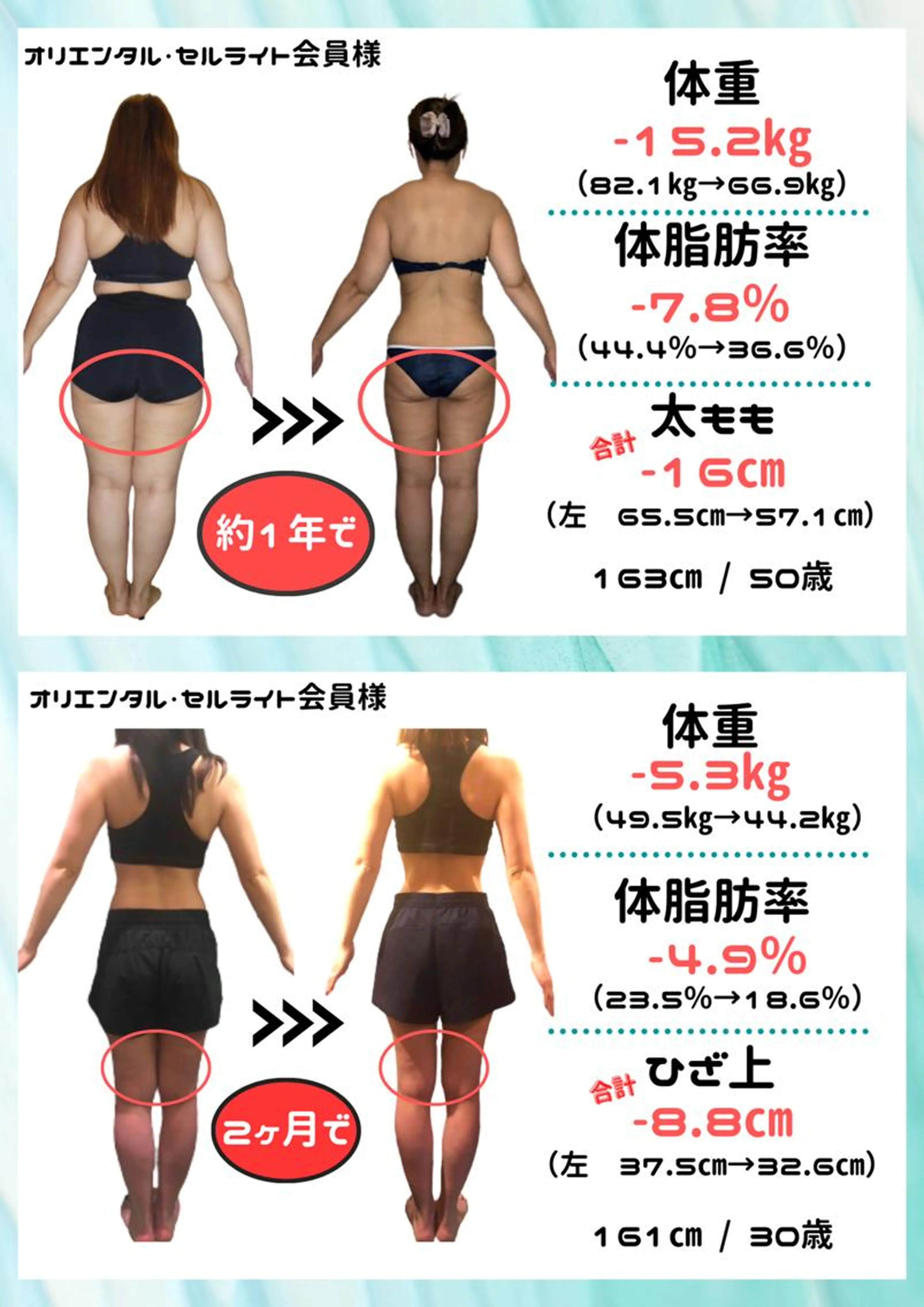 <A相談>[¥66,000で10kg減量まで♪]全身痩身!目標体重まで無期限通い放題コース+3年補償★150分¥0の写真