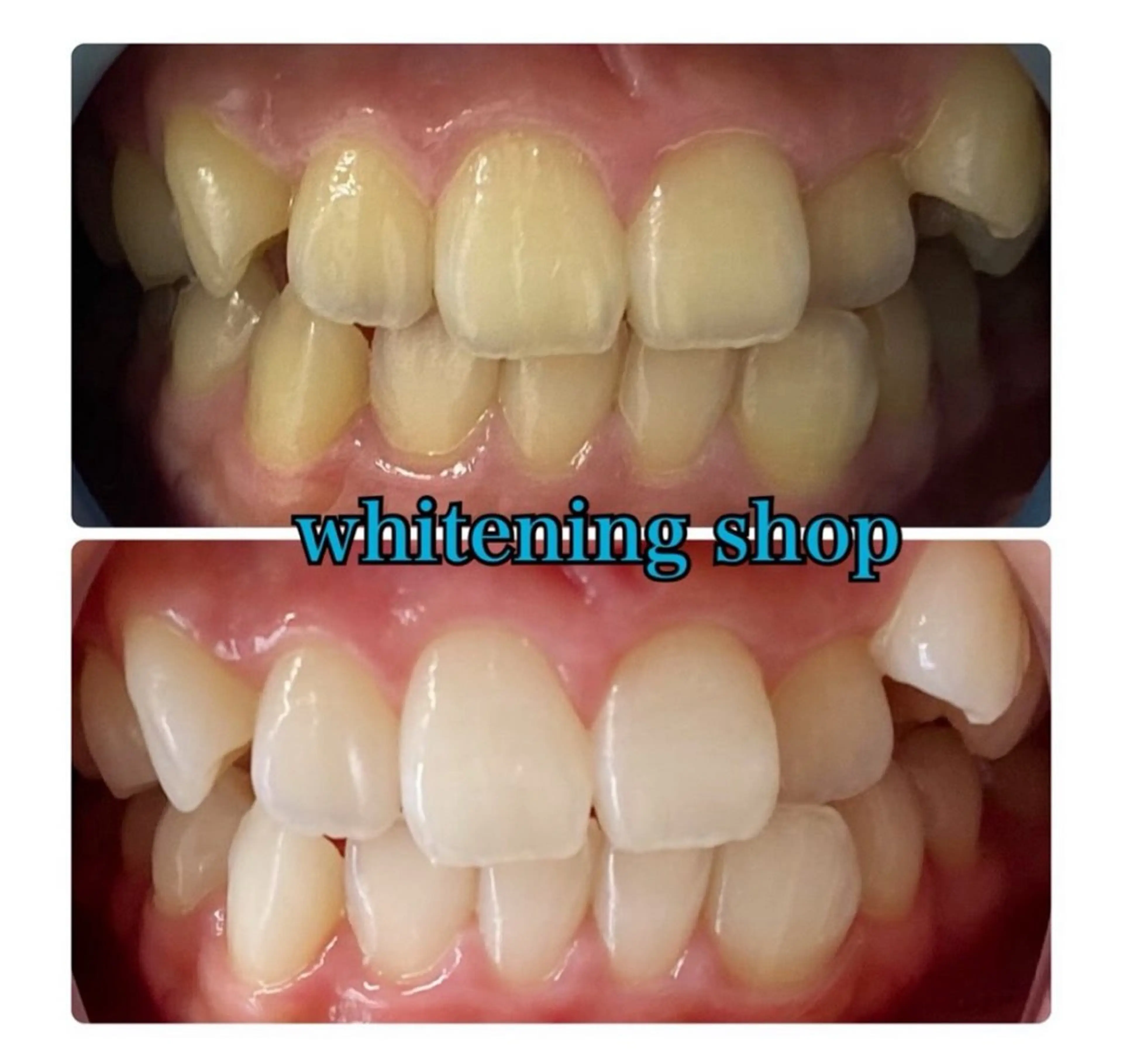 ホワイトニング ショップ津店のその他イメージ