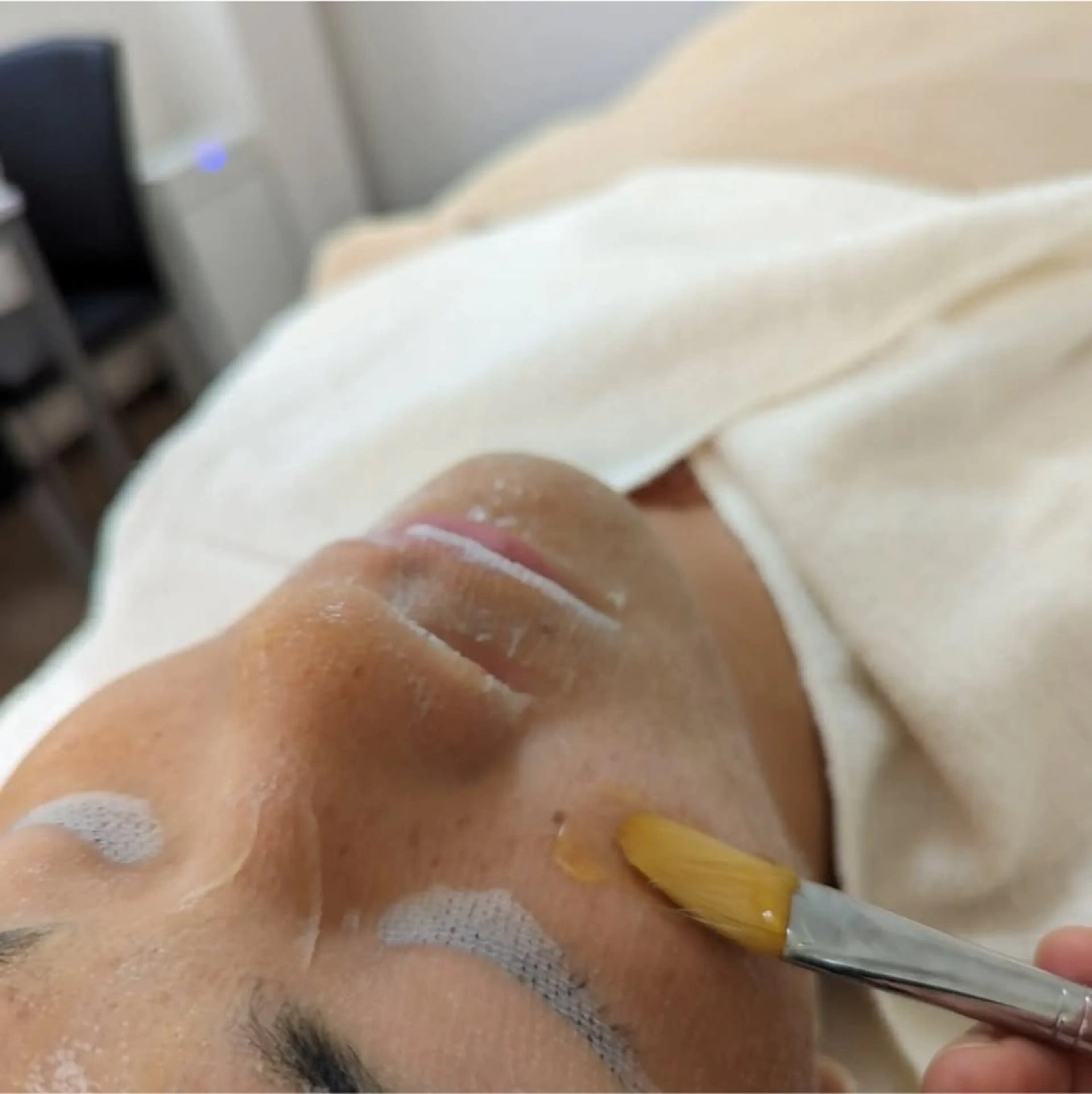 〈ニキビケアサロン〉 レゾン京橋店/ 浅川のエステ・リラクイメージ