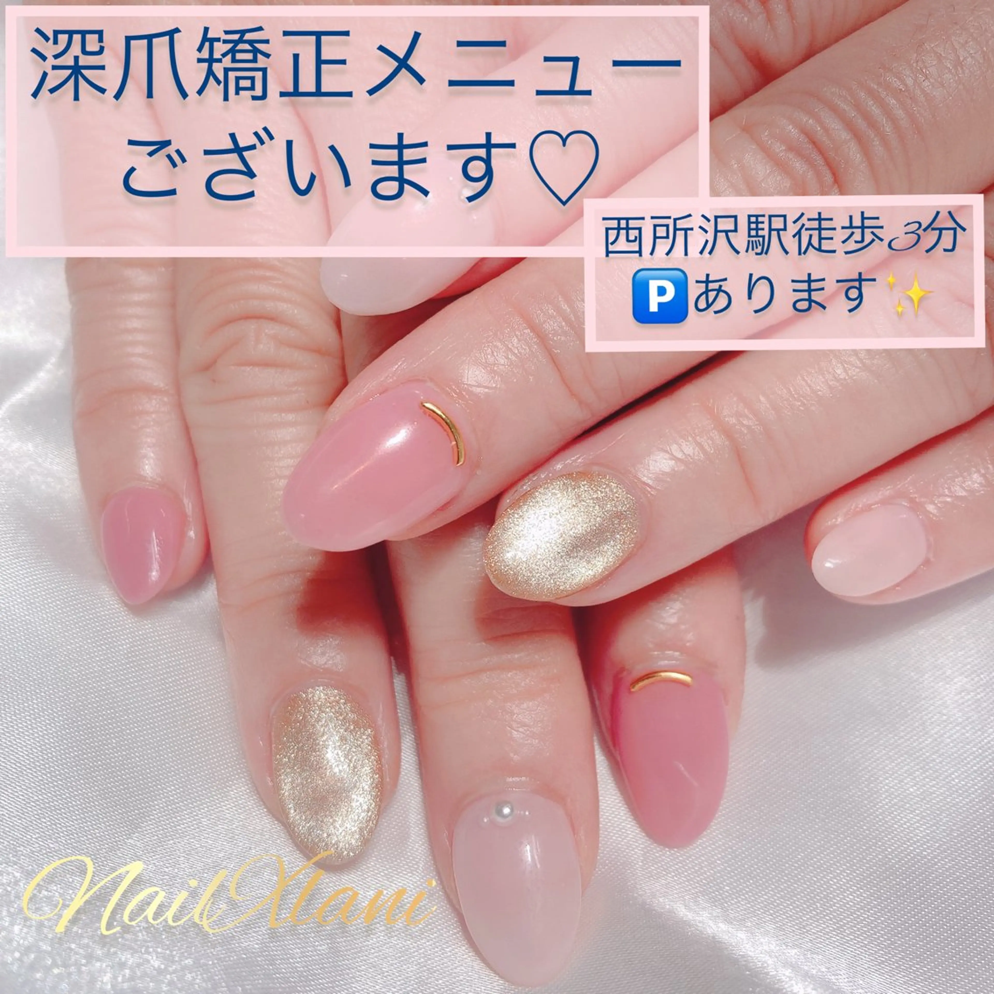 ネイル Nail×Lani 深爪矯正対応◎のネイルデザイン