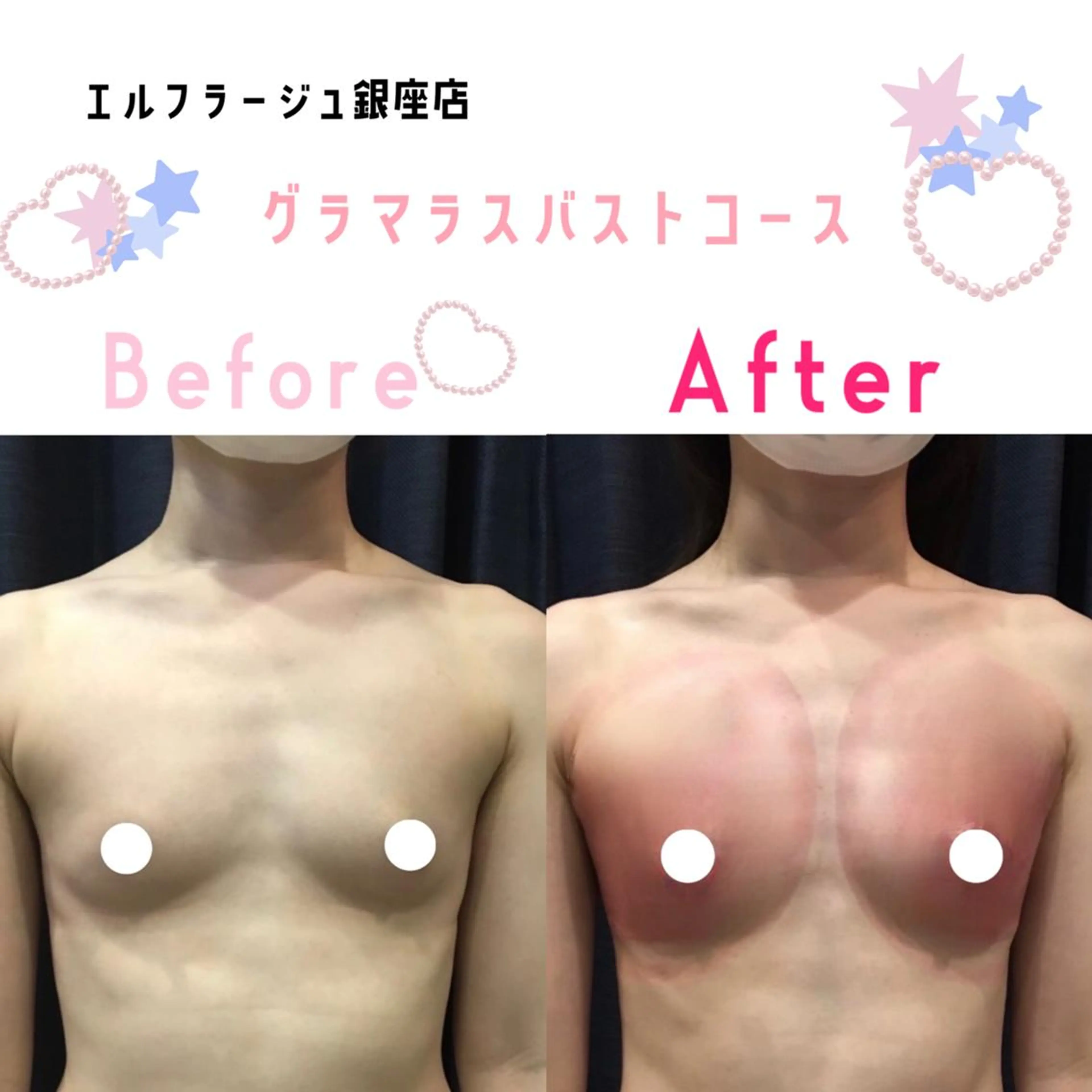 エルフラージュ 銀座店のエステ・リラクイメージ