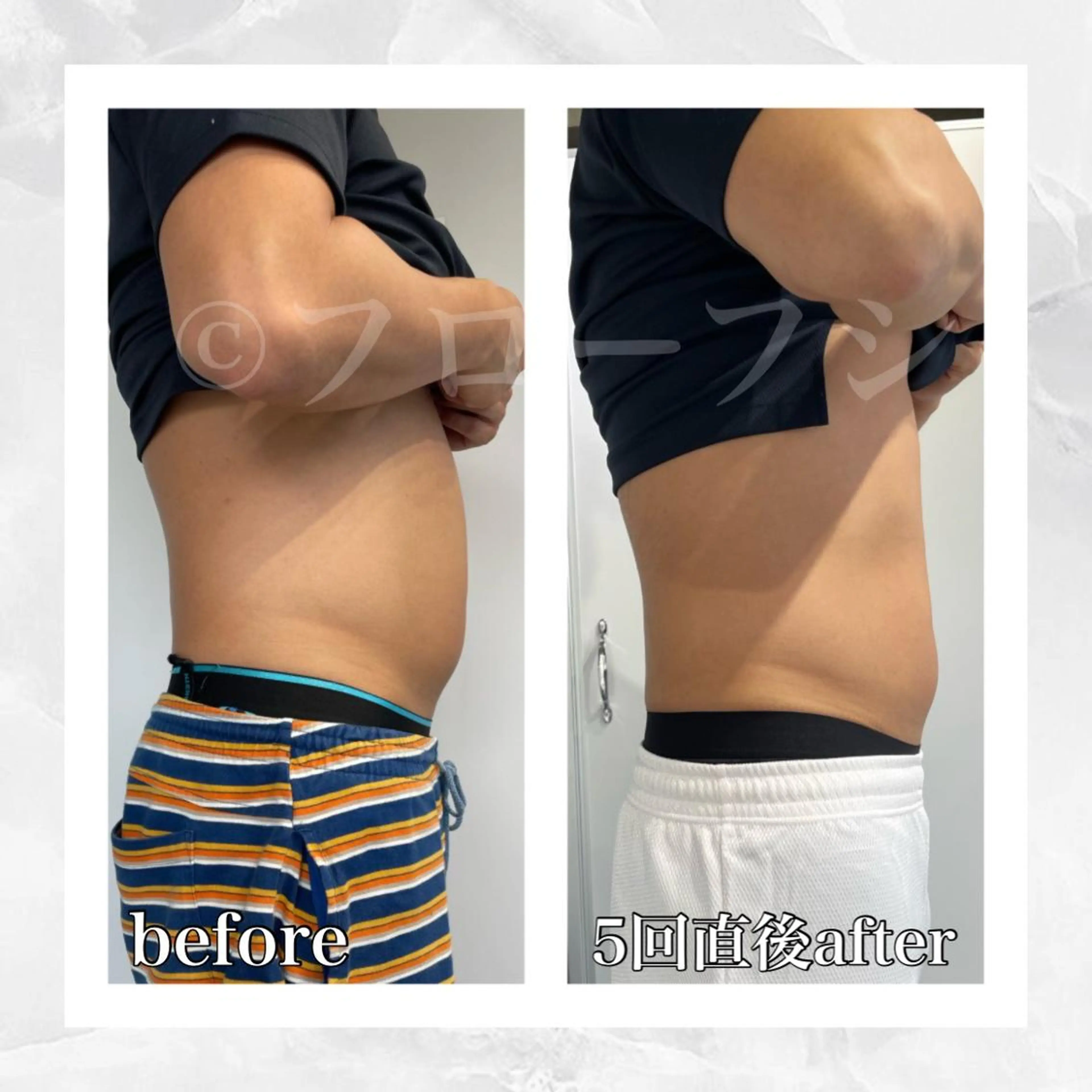 エステ リラク 部分痩せ♥️小顔専門 MIKUのエステ・リラクイメージ