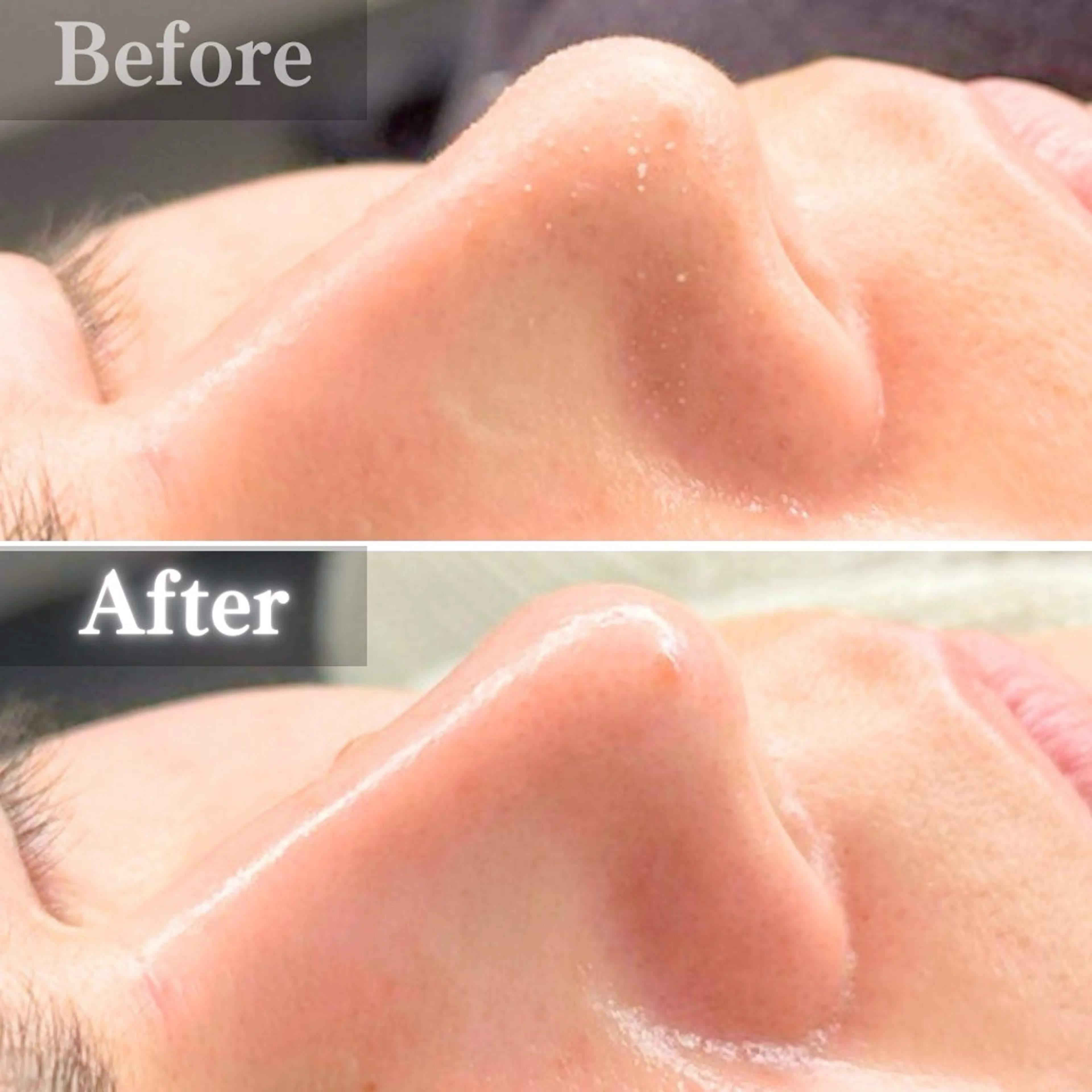 エステ 毛穴洗浄特化🫧 オオツカのエステ・リラクイメージ