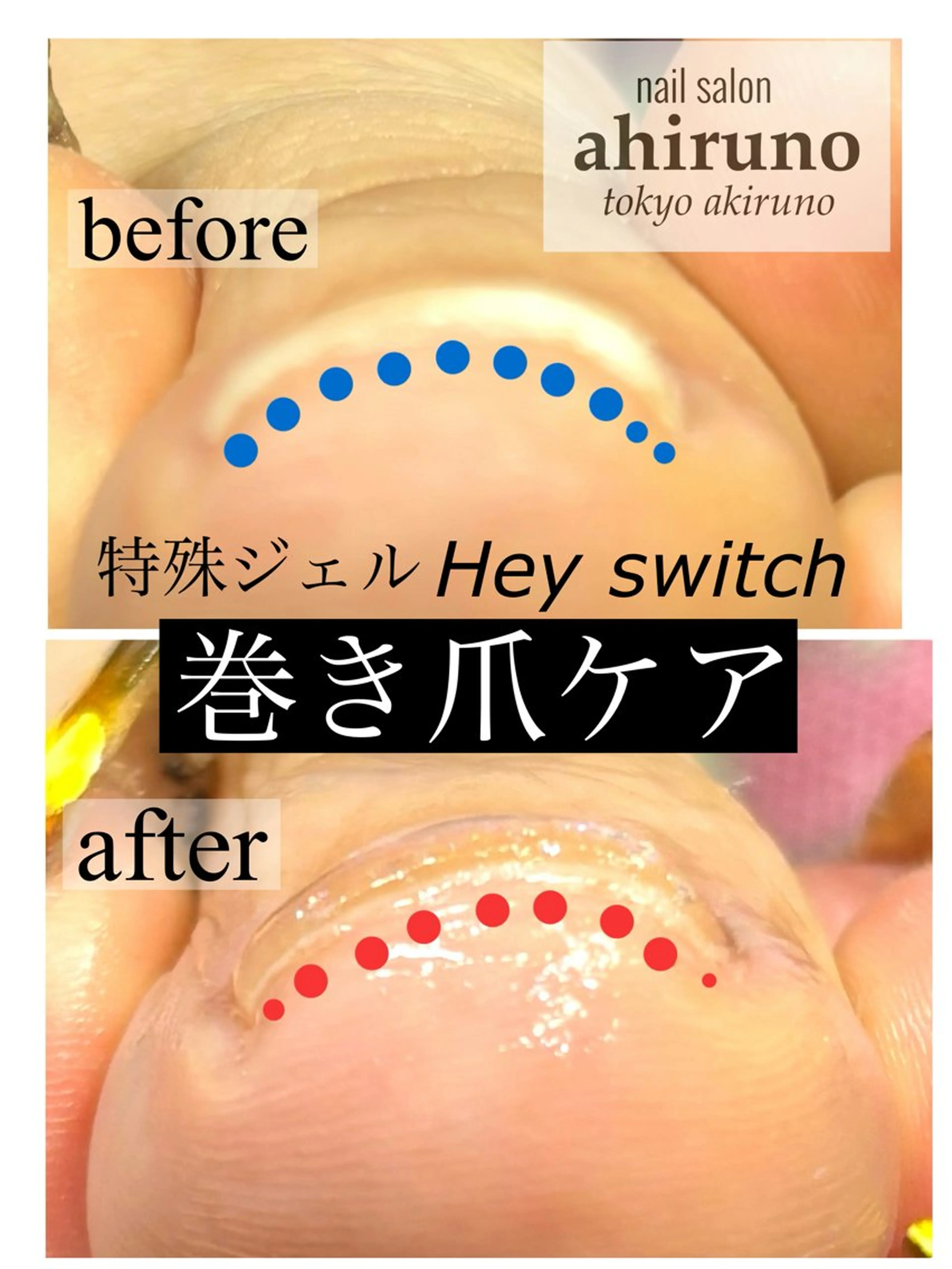 ネイル フットネイル 東京あきる野市ネイル ✿ yuiのネイルデザイン