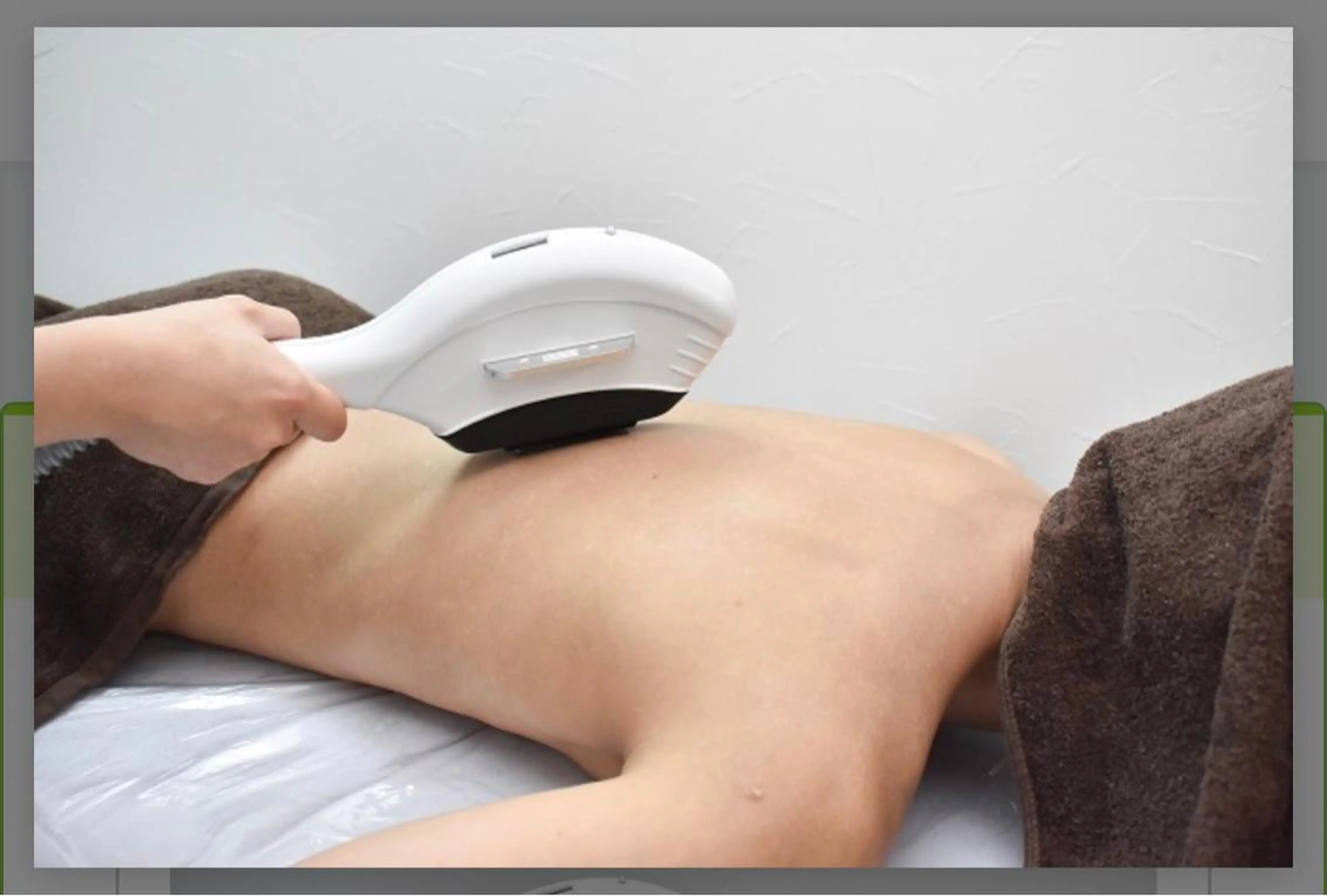 ladies顔、VIO含む全身光脱毛の写真