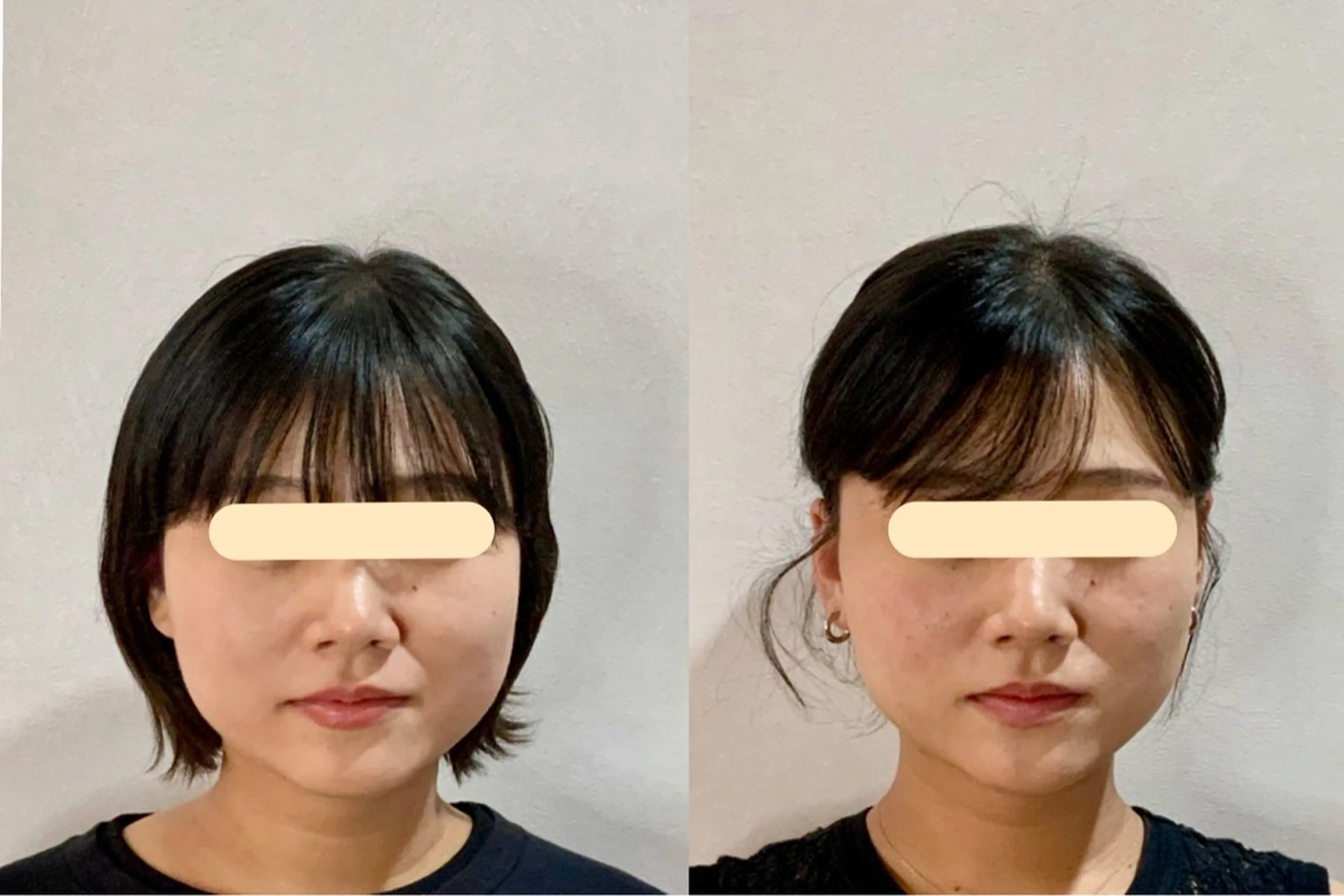 エステ リラク 最速小顔・肌質管理 espoirマキのエステ・リラクイメージ