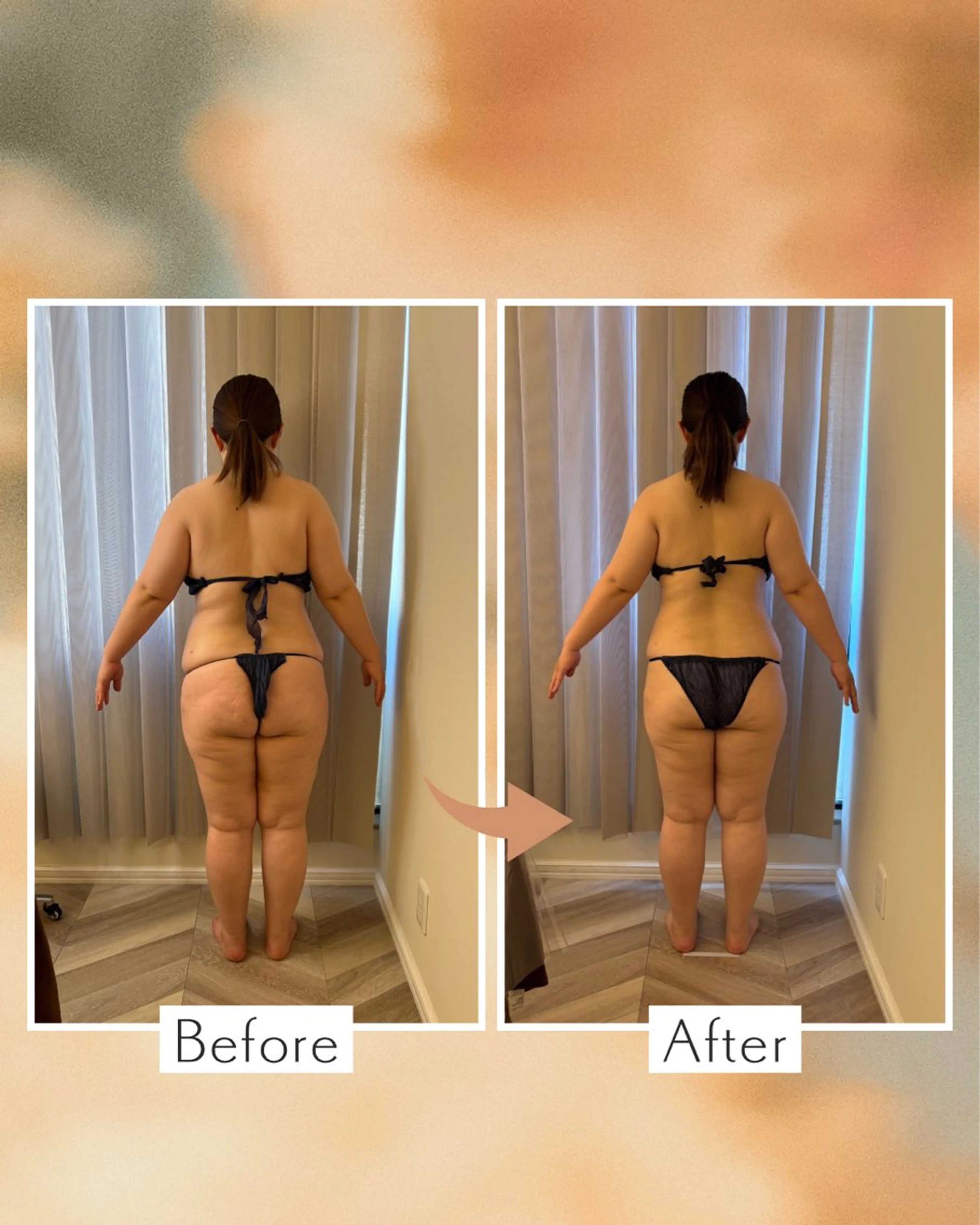 エステ 美肌脱毛／ニキビ ／肩こり／慢性疲労のエステ・リラクイメージ