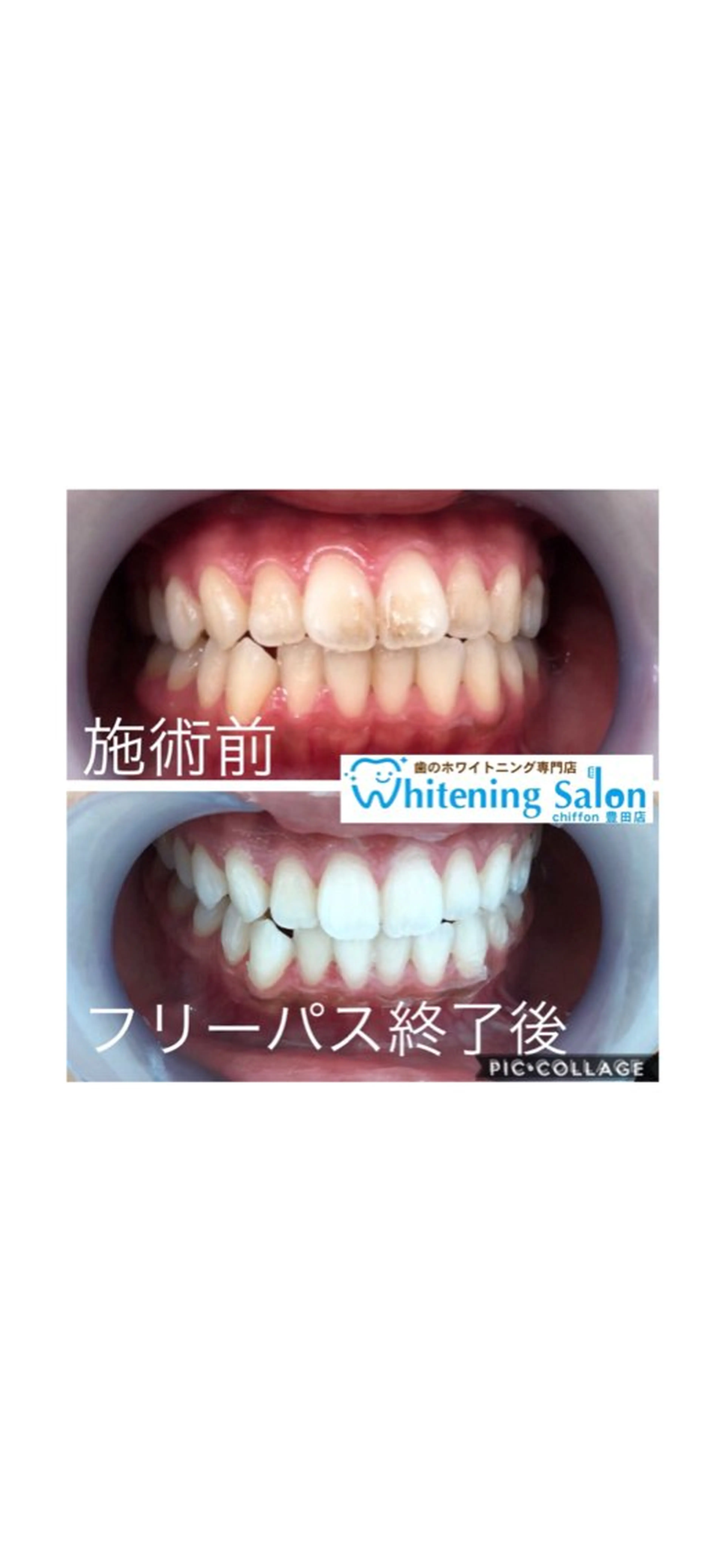 ホワイトニングサロン シフォン豊田店のエステ・リラクイメージ