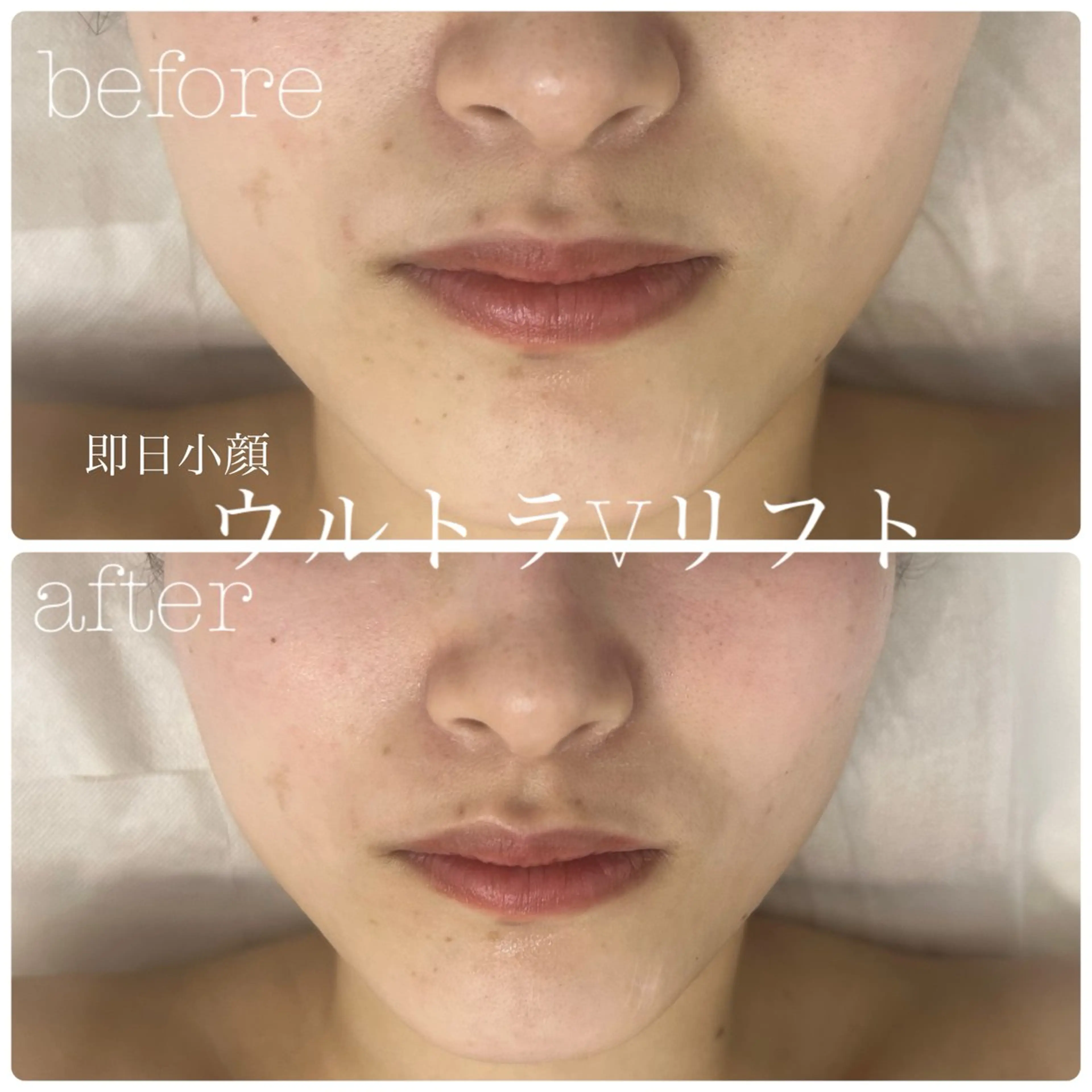 エステ フェイシャルサロン CHIARA 荒田のエステ・リラクイメージ