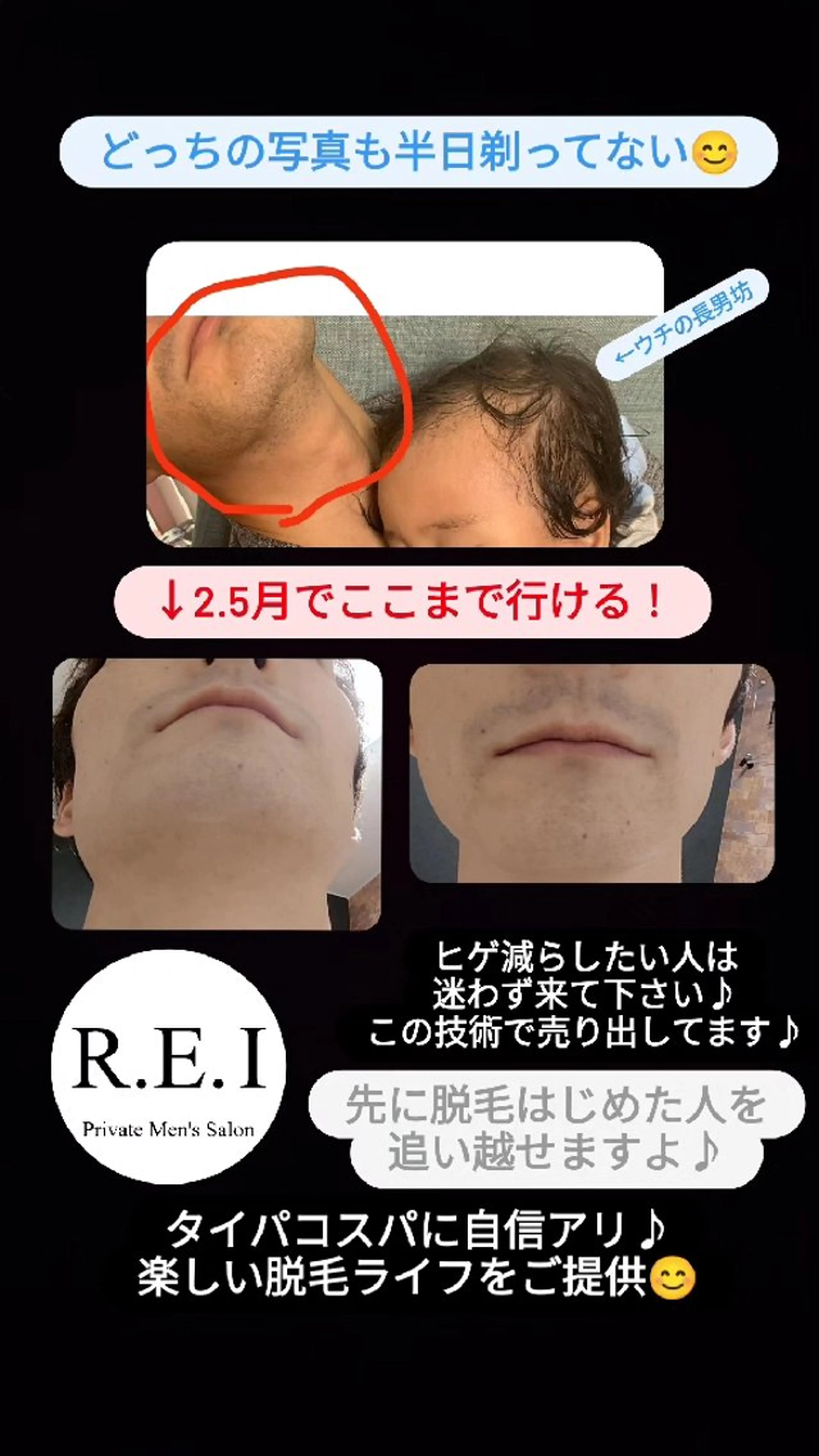 メンズ R.E.I　大学生 急増中！U22割有りのエステ・リラクイメージ