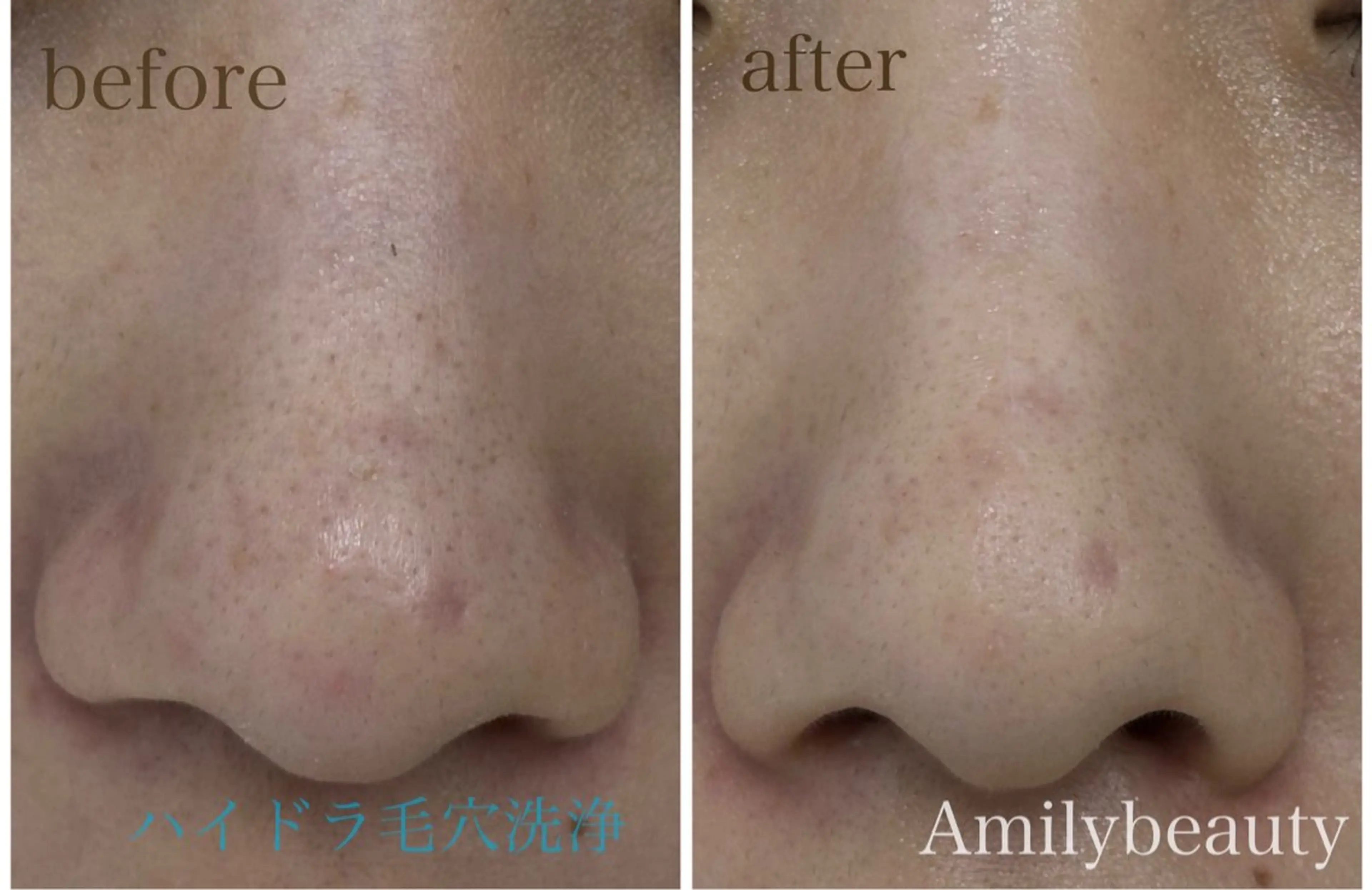 エステ Amily beauty 毛利のエステ・リラクイメージ