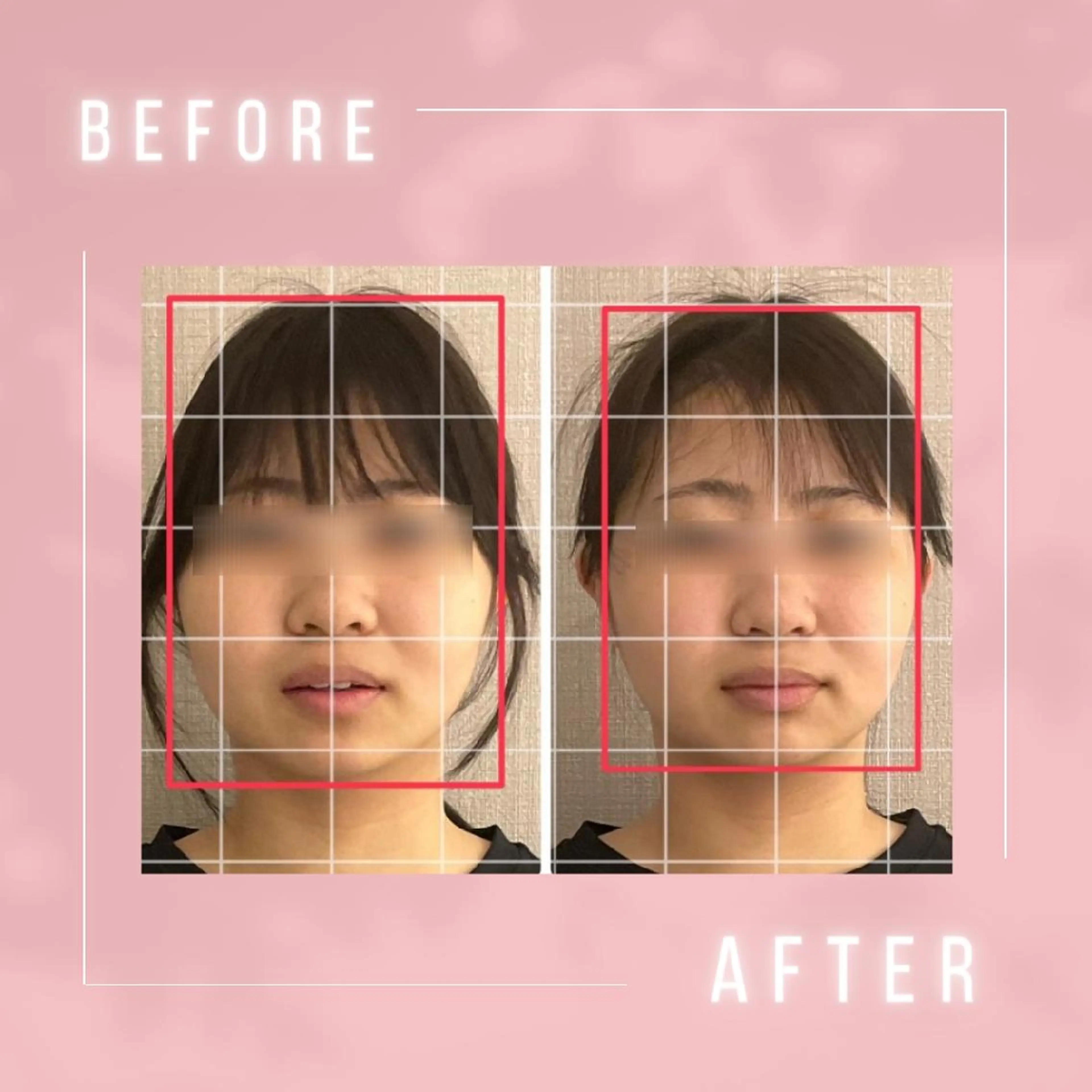 小顔・肌悩み専門店 ボーテドリッシュのエステ・リラクイメージ