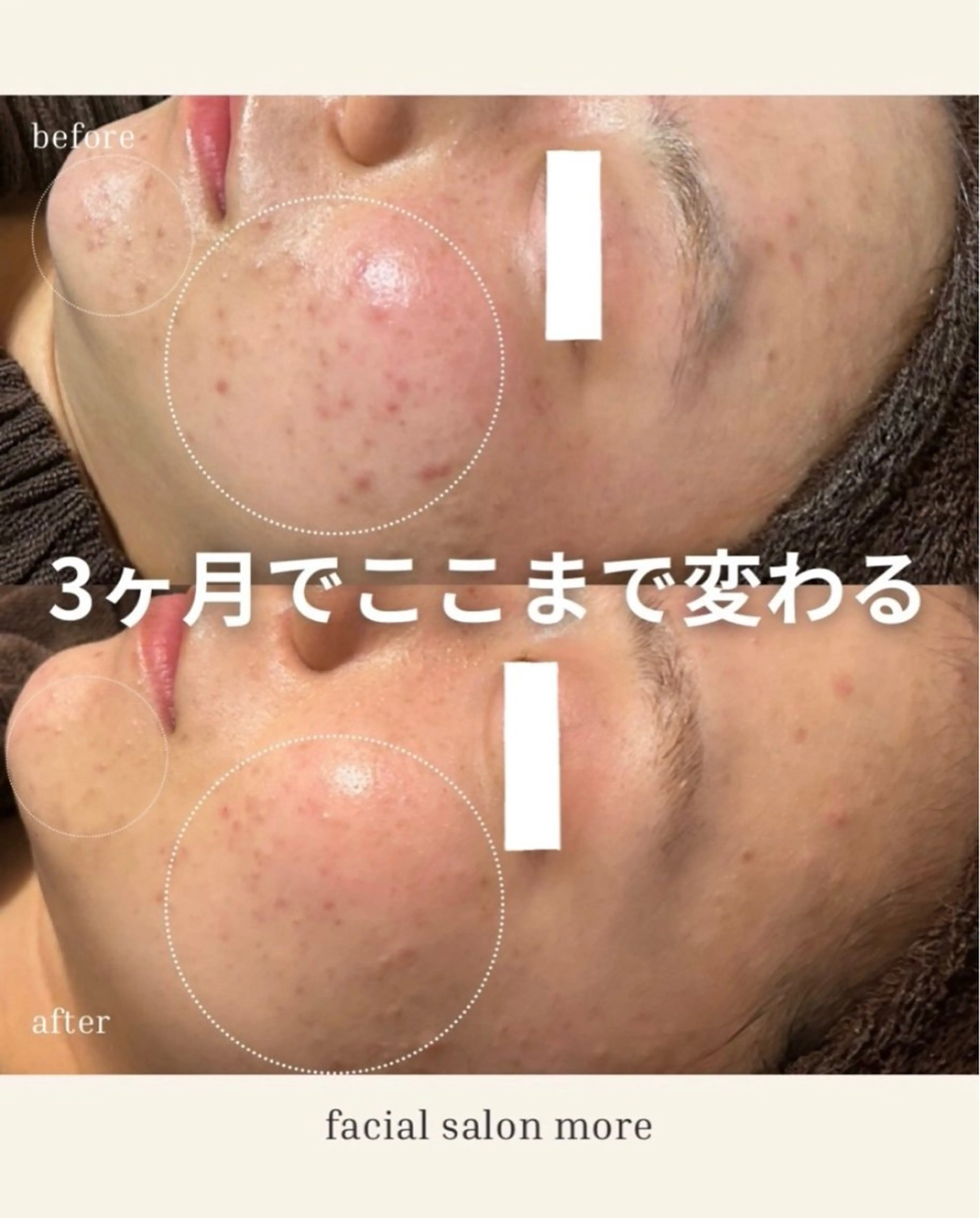 花田 裳逢のエステ・リラクイメージ