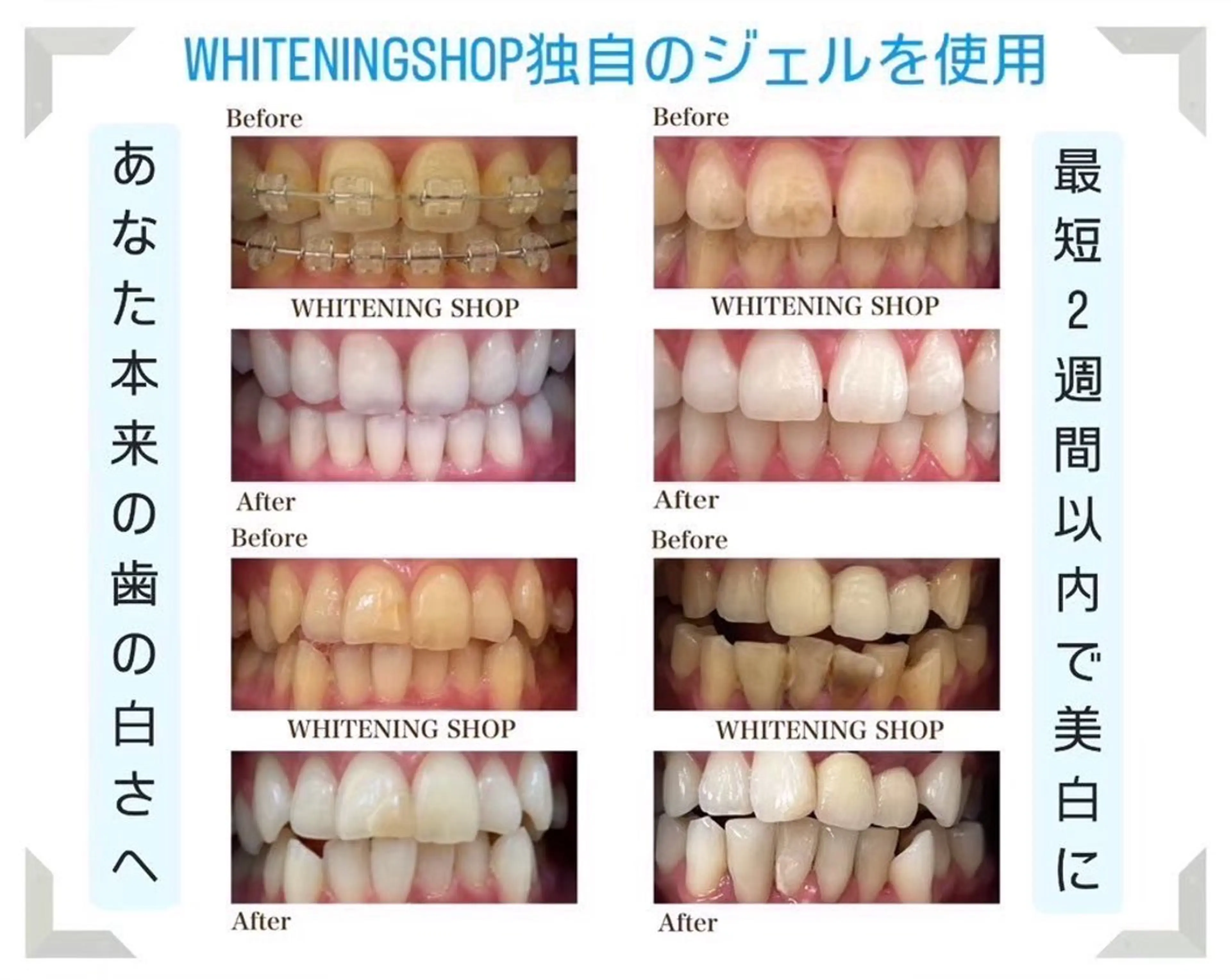 ホワイトニング ショップ葵区静岡駅店のその他イメージ