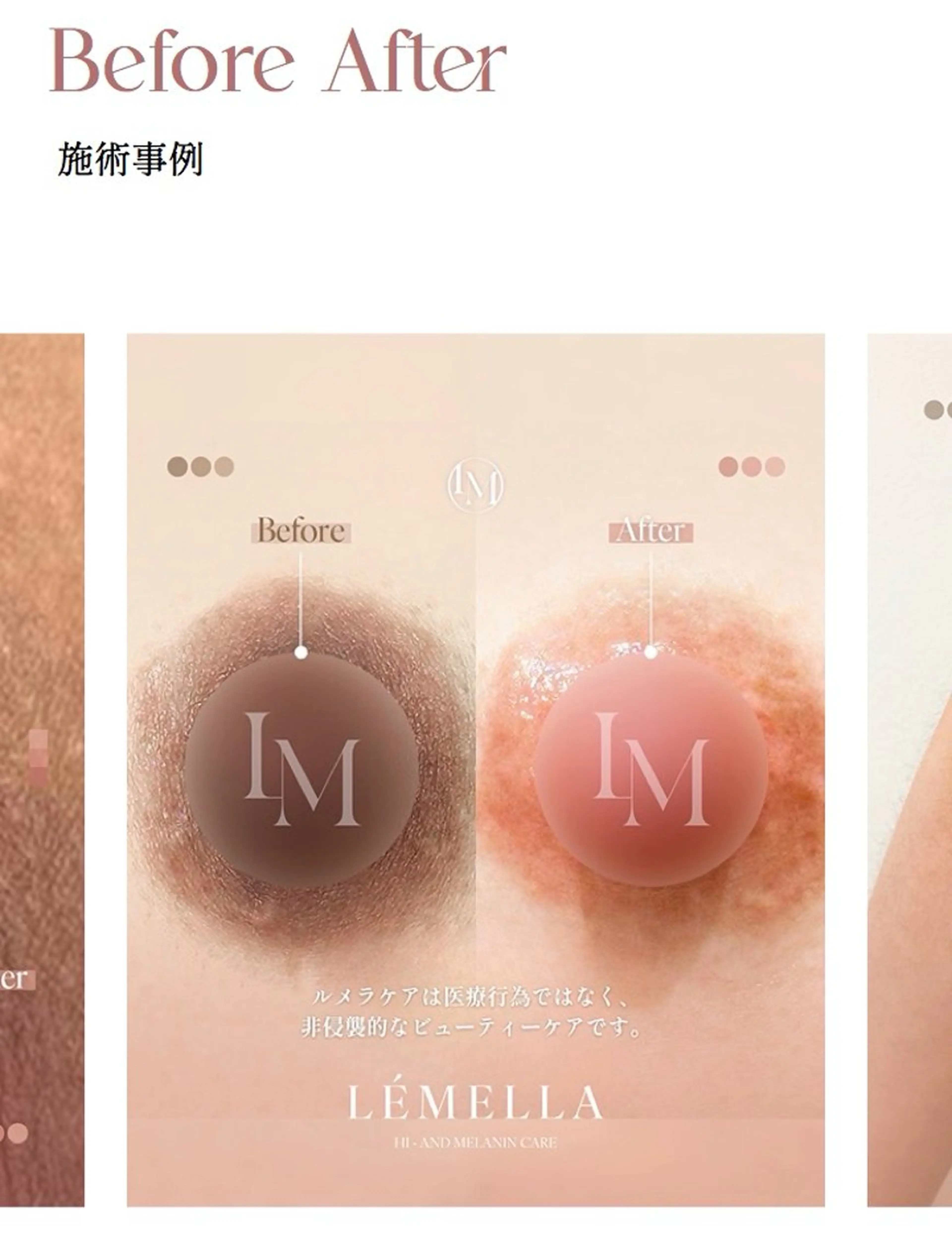 felicite🌱 プライベートサロンのエステ・リラクイメージ