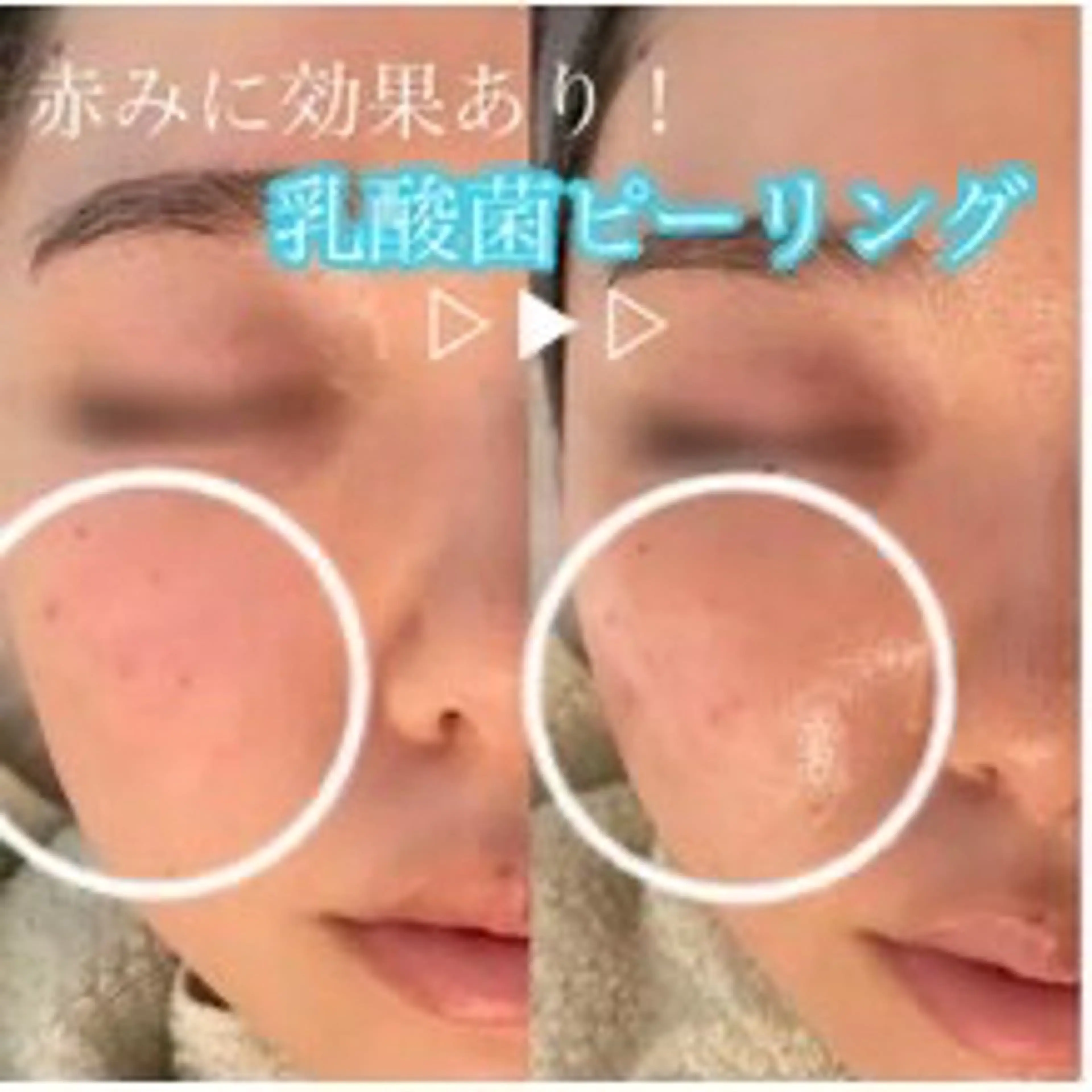 小顔コルギ・美肌 グラシーズのエステ・リラクイメージ